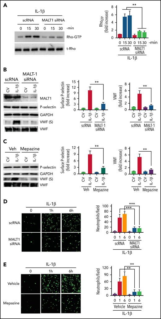 MALT-1 regulates IL-1β–induced Rho activation, mobilization of P-selectin and VWF, and neutrophil adhesion to activated endothelial cells. (A) MALT1 silencing suppresses IL-1β–induced Rho activation in endothelial cells. HUVECs were transfected with 200 nM of scRNA or MALT1 siRNA. After 48 hours, the transfected cells were treated with IL-1β for indicated time periods. Rho activation was measured as GTP-bound Rho as described in the Methods section. The left panel shows a representative blot (t-Rho in the blot indicates total Rho). The right panel shows the quantification of Rho-GTP concentrations from densitometric analysis of signals of immunoblots. Rho-GTP concentrations measured in scRNA-transfected cells and not treated with IL-1β were taken as 1, and other values were shown relative to this value. (B) MALT1 silencing inhibits IL-1β–induced translocation of P-selectin to the cell surface and secretion of VWF. HUVECs transfected with scRNA or MALT1 siRNA were treated with a control vehicle or IL-1β for 1 hour. After 1 hour, the cell supernatants were collected, and cell lysates were harvested. Cell supernatants were precipitated with TCA to concentrate proteins. Cell lysates were probed for MALT1, P-selectin, and VWF by immunoblot analysis; cell supernatants were probed for VWF by immunoblot analysis to assess the concentrations of secreted (S) VWF (left panel). The translocation of P-selectin to the cell surface was measured by cell surface ELISA (middle panel). VWF secretion was quantified by densitometric analysis of VWF (S) immunoblots (right panel). Concentrations of P-selectin on the cell surface and secreted VWF measured in cells transfected with scRNA and treated with a control vehicle were taken as 1.0, and other values were shown relative to these. (C) Pharmacological inhibition of MALT1 attenuates IL-1β–induced P-selectin translocation to the cell surface and secretion of VWF. HUVECs were treated with MALT1 inhibitor, mepazine (20 µM), or vehicle (veh) for 1 hour. After that, the cells were treated with a control vehicle (CV) or IL-1β for 1 hour. The assessment of P-selectin translocation to the cell surface and VWF secretion was performed as described in (B). (D-E) (D) MALT1 silencing or (E) pharmacological inhibition attenuates neutrophil adhesion to IL-1β–activated endothelial cells. HUVECs cultured on cover glasses were transfected with scRNA, MALT1 siRNA, or treated with MALT1 inhibitor, mepazine, as described in the figure legends of (B-C). HUVECs were stimulated with IL-1β for 1 or 6 hours. After washing the cells, PKH-labeled human neutrophils (5 × 105/mL) were added to endothelial cells. After 30 minutes, the unbound neutrophils were removed, and endothelial cells were washed. Neutrophils adhered to endothelial cells were fixed in 4% PFA for 15 minutes. The cells were visualized and imaged under 20× magnification using a confocal microscope (left panel). The cell count enumerated at 3 random locations of each cover glass of 3 independent experiments was shown in the bar graph (right panel). **P < .01 and ***P < .001.