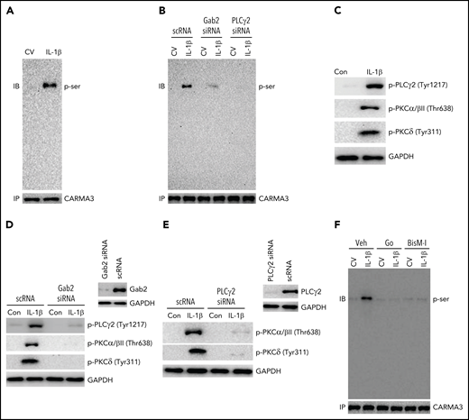 Gab2/PLCγ2/PKC axis mediates IL-1β–induced activation of CARMA3. (A) IL-1β treatment induces the phosphorylation of CARMA3 in endothelial cells. HUVEC were treated with a control vehicle or IL-1β for 5 minutes. The cells were lysed in radioimmunoprecipitation assay (RIPA) buffer, and the CARMA3 was immunoprecipitated using polyclonal CARMA3 antibodies. The immunoprecipitates were subjected to immunoblot analysis and probed with monoclonal antibodies against phosphoserine. (B) Gab2 or PLCγ2 silencing blocks IL-1β–induced phosphorylation of CARMA3. HUVECs transfected with scRNA, Gab2 siRNA, or PLCγ2 siRNA were treated with a control vehicle or IL-1β for 5 minutes. The cell lysates were immunoprecipitated with CARMA3 antibodies, and the immunoprecipitates were probed for the presence of phosphorylated CARMA3, as described in the legend to panel (A). (C) IL-1β induces the activation of PLCγ2 and PKC isomers in endothelial cells. HUVECs were treated with a control vehicle or IL-1β for 5 minutes. At the end of the 5-minute treatment, the cell lysates were harvested and probed for the phosphorylation of PLCγ2, PKCα/β, and PKCδ by immunoblot analysis using antibodies against phosphorylated PLCγ2, PKCα/β, and PKCδ. (D) Gab2 silencing inhibits IL-1β–induced activation of PLCγ2 and PKC isomers in endothelial cells. HUVECs were transfected with scRNA or Gab2 siRNA (200 nM). After 48 hours, the Gab2 knockdown was confirmed by immunoblot analysis. HUVECs transfected with scRNA or Gab2 siRNA were treated with a control vehicle or IL-1β for 5 minutes. The cell lysates were probed for the presence of phosphorylated PLCγ2, PKCα/β, and PKCδ by immunoblot analysis. (E) PLCγ2 silencing blocks the IL-1β–induced activation of PKC isomers. HUVECs were transfected with scRNA or PLCγ2 siRNA. After 48 hours, PLCγ2 knockdown was confirmed by immunoblotting. HUVECs transfected with scRNA or PLCγ2 siRNA were treated with a control vehicle or IL-1β for 5 minutes. The phosphorylation of PKCα/β and PKCδ were analyzed by immunoblot analysis. (F) Inhibition of PKC attenuates IL-1β–induced phosphorylation of CARMA3. HUVECs were treated with PKC α/β inhibitor Go6976 (Go; 100 nM), pan-PKC inhibitor bisindolylmaleimide 1 (BisM-1; 500 nM), or DMSO vehicle for 1 hour. After that, the cells were treated with a control vehicle or IL-1β for 5 minutes. The cell lysates were processed as described in the panel (D) and probed for the phosphorylation of CARMA3. The immunoblots shown were the representative blots of 3 independent experiments with similar results.