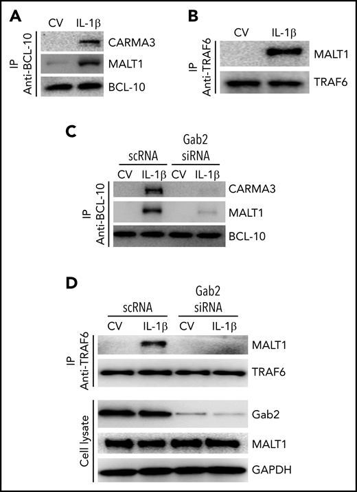 Gab2 facilitates IL-1β–induced assembly of the CBM signalosome and MALT1 interaction with TRAF6. (A) IL-1β induces the formation of the CBM signalosome. HUVECs were treated with a control vehicle or IL-1β for 5 minutes. The cell lysates were immunoprecipitated with BCL-10 antibodies, and the immunoprecipitates were probed for the presence of CARMA3, MALT1, and BCL-10 by immunoblot analysis. (B) IL-1β induces MALT1 association with TRAF6. HUVECs were treated with a control vehicle or IL-1β for 5 minutes, and the cell lysates were immunoprecipitated with TRAF6 antibodies. The immunoprecipitates were probed for the presence of MALT1 and TRAF6. (C) Gab2 silencing prevents IL-1β–induced CBM signalosome formation. HUVECs were transfected with scRNA or Gab2 siRNA (200 nM). After 48 hours, the cells were treated with a control vehicle or IL-1β for 5 minutes. The cell lysates were immunoprecipitated with BCL-10 antibodies, and the immunoprecipitates were probed for the presence of CARMA3, MALT1, and BCL-10 by immunoblot analysis. (D) Gab2 silencing abolishes IL-1β–induced MALT1 association with TRAF6. HUVECs transfected with scRNA or Gab2 siRNA were treated with a control vehicle of IL-1β for 5 minutes. The cell lysates were immunoprecipitated with TRAF6 antibodies, and the immunoprecipitates were probed for the presence of MALT1 and TRAF6. In addition, cell lysates were probed for Gab2, MALT1, and GAPDH.