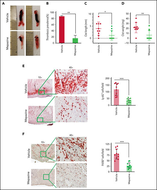 MALT1 inhibition protects against venous thrombosis induced by flow restriction. C57/BL 6J wild-type mice were administered 2 doses of MALT1 inhibitor, mepazine (12.5 mg/kg body weight each dose, intraperitoneally), the first dose 2 hours before surgery, and a second dose 24 hours after the IVC ligation. Control mice were administered with a control vehicle (DMSO). Mice were subjected to the IVC ligation-induced stenosis. Forty-eight hours following the IVC ligation, mice were killed, and thrombus formation in the ligated vein was evaluated. (A) Representative images of thrombus; (B) thrombosis prevalence; (C) thrombus length; (D) thrombus weight. Thrombi collected were processed for tissue sectioning, and sections were stained with antibodies against (E) Ly-6G or (F) F4/80 antigens. The sections were visualized under a bright field microscope at 10×, and selected areas (boxed) were viewed at 40× magnification. The number of LY-6G or F4/80-positive cells was analyzed at 10 randomly chosen areas of the high-power field covering the entire section of 10 different mice. Data are mean ± standard deviation of 3 independent experiments. *P < .05, **P < .01, and ***P < .001.