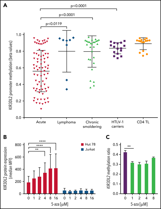 KIR3DL2 promoter is hypomethylated in patients with acute-type ATL. (A) Differential methylation at the KIR3DL2 locus using the β-value method, measured in an Illumina 450K array-based methylome analysis in samples from patients with ATL (19 acute, 2 lymphoma, and 7 chronic/smoldering forms), 4 HTLV-1 carriers, and 4 healthy donors (isolated CD4+ TL). The KIR3DL2 promoter was significantly less methylated in acute-type ATL than in lymphoma- and chronic/smoldering-type ATLs or HTLV-1 ACs (unpaired t test). The proportion of tumor cells was greater than 85% in the acute-type ATL samples. Each dot represents an individual CpG per patient in the β-value analysis. The horizontal line represents the median, and the whiskers represent the range. (B) KIR3DL2 protein expression was induced on Hut 78 cells, but not on Jurkat cells, upon incubation with 5-aza (0, 1, 2, 4, 8, or 16 μM) for 3 days. The error bars correspond to the standard deviation. ****P < .0001; **P < .01 (2-way analysis of variance followed by Šidák’s post hoc test). MFI, mean fluorescence intensity. (C) 5-Aza led to hypomethylation of KIR3DL2 promoter, assessed by MS-MLPA, in Hut 78 cells treated with 5-aza from 1 μM. Experiment performed in triplicate. **P < .01 (unpaired t-test).