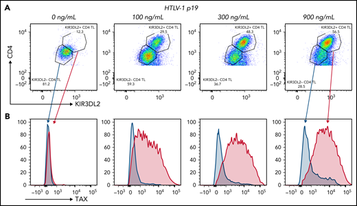 HTLV-1 infection in vitro induced the expression of KIR3DL2 by CD4+ T cells (representative assay). (A) Cell-free HTLV-1 virions induced the expression of KIR3DL2 by CD4+ T cells after 7 days of culture. PBMCs from healthy donors were cultured with increasing concentrations of HTLV-1 (p19-equivalent), and KIR3DL2 cell surface expression was quantified by FC. Purified HTLV-1 virions induced KIR3DL2 expression by CD4+ T cells in a dose-dependent manner. (B) TAX mRNA was mostly expressed by KIR3DL2+ CD4+ lymphocytes and was not observed in KIR3DL2− CD4+ lymphocytes, quantified using the PrimeFlow RNA assay and KIR3DL2 immunolabeling.