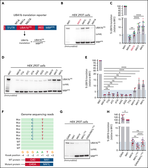 Residual UBA1b translation defines a threshold for VEXAS syndrome pathogenesis. (A) Schematic overview of the translation reporter system used to determine UBA1b translation. The first cistron of these reporters is translated in a CAP-dependent mechanism and encodes for C-terminally HA-tagged UBA1 constructs varied in p.Met41 and mutated at p.Met1 and p.Met67 (to suppress UBA1a and UBA1c translation and thus allowing for sensitive quantification of UBA1b by anti-HA immunoblotting). The second cistron is translated using an IRES and encodes for a C-terminally HA-tagged MBP, which is used for normalization across different p.Met41 variants. (B) p.Met41Val supports less UBA1b translation than p.Met41Thr and p.Met41Leu. Anti-HA immunoblot analysis of HEK293T lysates expressing indicated UBA1b translation reporters. (C) Quantification of the experiment shown in panel B. Error bars denote SD, n = 12 (4 biological with 3 technical replicates each; technical replicates of each biological replicate are depicted in the same color and symbol), **P < .01; ****P < .0001, ordinary 1-way ANOVA. (D) The canonical VEXAS variants (p.Met41Val/Thr/Leu) support more UBA1b translation than any of the other possible single-nucleotide variants at the Met41 start codon. Anti-HA immunoblot analysis of HEK293T lysates expressing indicated UBA1b translation reporters. (E) Quantification of the experiment shown in panel D. Error bars denote SD, n = 4 (2 biological with 2 technical replicates each; technical replicates of each biological replicate are depicted in the same color and symbol), *P < .05; ****P < .0001, ordinary 1-way ANOVA. (F) Two novel VEXAS variants (c.121 A>T; p.Met41Leu and c.119 G>C; p.Gly40Ala) are present in a patient in cis on the same allele. Overview of the genome sequencing reads of the p.Met41LeuTTG/p.Gly40Ala patient. (G) The p.Gly40Ala variant rescues residual UBA1b translation of the p.Met41LeuTTG to the level of the canonical VEXAS variant p.Met41Val. Anti-HA immunoblot analysis of HEK293T lysates expressing indicated UBA1b translation reporters. (H) Quantification of the experiment shown in panel G. Error bars denote SD, n = 10 (2 biological with 5 technical replicates each; technical replicates of each biological replicate are depicted in the same color and symbol), **P < .01; ****P < .0001, ordinary 1-way ANOVA. Shaded area represents minimum threshold below p.Met41Val expression. SD, standard deviation.