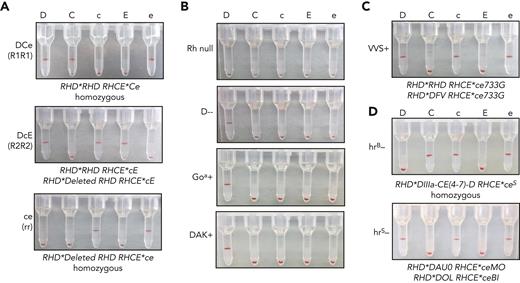 Detection of Rh antigen expression on iRBCs by gel column agglutination. (A) Rh antigen typing of DCe/DCe (R1R1), DcE/cE (R2R2), and ce/ce (rr) esRBCs or iRBCs using commercial monoclonal RBC typing reagents for the 5 common Rh antigens (anti-D, anti-C, anti-c, anti-E, and anti-e indicated above) on buffered gel cards. Agglutination prevents cells from traveling through the gel matrix to the bottom of each column upon centrifugation and indicates cell surface expression of the corresponding antigen. (B-D) (B) Rh typing for common Rh antigens of Rh null, D--, D+ Goa+, and D+ DAK+ iRBCs, and (C) D+c+e+, VVS+ iRBCs, and (D) C+c+e+, hrB− and D+c+e+, hrS− ficin-treated iRBCs.