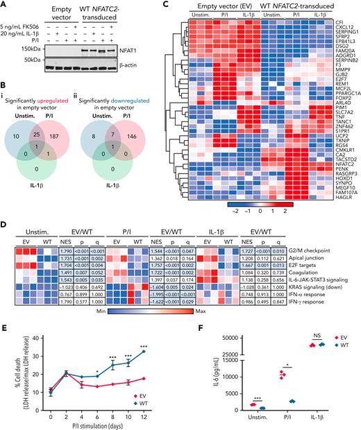 NFAT1 deficiency in chondrocytes leads to an increased prosurvival and proinflammatory phenotype. (A) Immunoblot of EV- and WT NFATC2–transduced patient chondrocytes before and after 15 minutes of P/I stimulation, 20 ng/mL IL-1β stimulation, or no treatment (n = 3). (B-D) RNA sequencing carried out on EV- or WT NFATC2–transduced patient chondrocytes unstimulated or stimulated for 24 hours with P/I or 20 ng/mL IL-1β. (B) Venn diagram of significantly (FDR < 0.05) upregulated (Bi) and downregulated (Bii) genes in EV-transduced patient chondrocytes compared with WT NFATC2–transduced chondrocytes. (C) Heat map of top genes that meet a FDR < 0.025 cutoff between EV and WT NFATC2–transduced patient chondrocytes. (D) Heat map of sample level enrichment scores with normalized enrichment scores, P-value, and q-values for each pathway determined by gene set enrichment analysis. Min and max refer to the row-normalized minimum and maximum for each pathway. (E) Measurement of percent cell death in chondrocytes over 12 days by quantifying LDH in supernatants. ∗P < .05, ∗∗∗P < .001, two-way analysis of variance, Dunnett’s post-hoc test. (F) Enzyme-linked immunosorbent assay detection of IL-6 production from the supernatants of chondrocytes in different conditions. ∗P < .05, ∗∗∗P < .001, Mann-Whitney U test. NS, not significant.