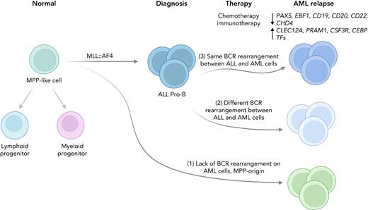 Models of the cell of origin of lineage-switched relapse in infant KMT2A-r leukemia. Tirtakusuma et al. identified 3 different scenarios: (1) relapsed AML cells lack BCR rearrangement; (2) both ALL and AML cells present BCR rearrangements but they are different; and (3) ALL and AML cells share the same BCR rearrangement.