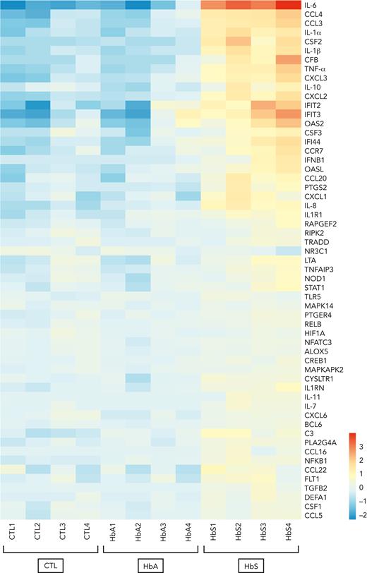 HbS is responsible for the activation of the NF-κB and type I interferon signaling pathways. mRNA expression profile of human monocytes from healthy blood donors (n = 4) after 4-hour incubation with HbS (20 μM), HbA (20 μM), or control (NanoString Inflammation Panel, Canopy Biosciences). Presented genes (n = 57 out of 255) are those with a statistically significant >1.5-increase in mRNA expression after incubation with HbS compared with HbA. Heat map representation of the 57 genes is ordered by hierarchical clustering, using a logarithmic scale color bar. IL-6, CCL3, CCL4, IL-1α, IL-1β, TNF-α, CXCL2, CXCL3, and IL-10 belong to the NF-κB signaling pathway, whereas IFIT2, IFIT3, OAS2, CSF3, IFI44, IFNB1, and OASL belong to the type I signaling pathway.