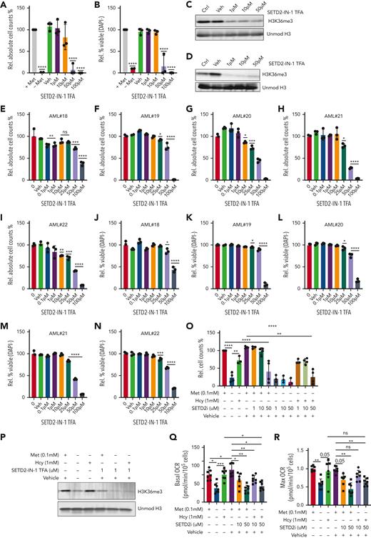 SETD2 inhibition phenocopies methionine depletion inducing cell death in AML samples. (A-B) Relative cell counts and relative viability of MOLM13 cells grown for 72 hours with and without methionine and with increasing concentrations of the SETD2 inhibitor, SETD2-IN-1 TFA (n = 3). (C) Western blot for H3K36me3 levels in MOLM13 cells following 24 hours of exposure to SETD2-IN-1. (D) Western blot for H3K36me3 levels in MOLM13 cells following 72 hours of exposure to SETD2-IN-1. Unmodified histone H3 was used as loading control. (E-N) Relative viable cell counts and viability (DAPI−), both shown as percentages, in 5 primary AML samples (AML#18-22) grown for 7 days in liquid culture with a concentration range of SETD2-IN-1 TFA. The proliferation index of 4 of these 5 AMLs can be seen in supplemental Figure 9M-P, where the control conditions were the same and performed at the same time. (O) Relative cell counts for MOLM13 cells grown for 48 hours with or without methionine, with and without 1 mM homocysteine (Hcy), with SETD2-IN-1 both alone and in combination with Hcy supplementation. n = 3-4 experiments combined from the Seahorse experiments and independent homocysteine rescue experiments). (P) Western blot for H3K36me3 levels in a MOLM13 Hcy rescue experiment, with and without exposure to SETD-IN-1 TFA. β-Actin and unmodified histone H3 were used as loading controls. (Q) Basal OCR in a MOLM13 Hcy rescue of methionine depletion with and without SETD-IN-1 TFA exposure. Forty-eight-hour experiment: (R) Max OCR in a MOLM13 Hcy rescue of methionine depletion with and without SETD-IN-1 TFA exposure. All experiments: error bars represent mean ± SEM. Statistical analysis by ordinary 1-way ANOVA, ∗P < .05, ∗∗P < .01, ∗∗∗∗P < .0001.