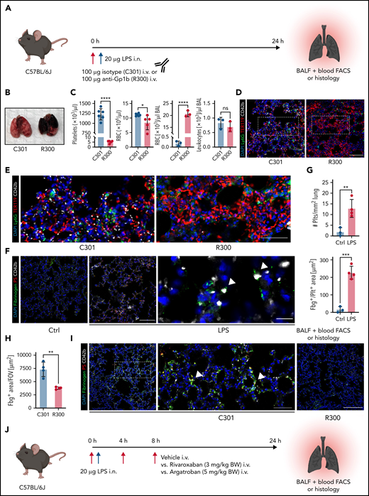 Both thrombocytopenia and anticoagulation aggravate inflammatory bleeding. (A) Experimental scheme of subacute lung injury model with or without antibody-mediated platelet depletion. The red arrow indicates antibody administration; the blue arrow indicates intranasal LPS administration. (B) Representative macroscopic images of lungs from control (C301) and thrombocytopenic animals (R300 treatment) 24 hours after LPS challenge. (C) Flow cytometric analysis of peripheral blood (platelet and RBC count) and BALF (RBC and leukocyte count/µL BALF). Student’s t test, two-tailed, unpaired. (D) Representative micrographs of immunofluorescence stainings of alveolar hemorrhage in control (C301) and thrombocytopenic animals (R300). Bar represents 100 µm. (E) Magnified excerpts of representative micrographs, corresponding to white rectangles in Figure 1D. Bar represents 50 µm. (F) Representative images of immunofluorescence stainings of lungs from control (Ctrl) or septic animals (E. coli–derived LPS 1 mg/kg BW intraperitoneally). Bar represents 100 µm (left and mid panel) and 20 µm (right panel). White arrowheads indicate fibrin(ogen)-positive platelets. Red: anti-PS antibody (Merck). (G) Quantification of fibrinogen deposition and overlap of fibrinogen/platelet positive areas. n = 3 to 4 mice per group. Student’s t test, two-tailed, unpaired. (H) Quantification of fibrinogen deposition in lungs from septic control (C301) and platelet-depleted animals (R300) per field of view (FOV). n = 4 mice per group. Student’s t test, two-tailed, unpaired. (I) Representative micrographs of control (C301) and platelet-depleted mice (R300), referring to (H). Bar represents 200 µm (left and right panels). Magnified excerpt (middle; bar represents 20 µm) corresponds to the white rectangle of the left panel. Red: anti-PS antibody (Merck). (J) Experimental scheme of (sub)acute lung injury. Bl6 mice were treated with 20 µg of LPS intranasally (blue arrow) and intravenously injected with vehicle or rivaroxaban (3 mg/kg BW) right before and 8 hours after challenge or argatroban (5 mg/kg BW) right before and 4 and 8 hours after challenge; rivaroxaban-treated animals received vehicle injections at 4 hours after challenge (red arrows indicate timing of intravenous injections). (K) Representative macroscopic image of BALF derived from 1 simultaneously performed set of experimental groups, collected in 2 mL Eppendorf tubes. The right tube corresponds to the maximum bleeding observed in argatroban-treated animals. (L) Flow-cytometric assessment of BALF (RBC, polymorphonuclear, and PLT counts/µL BALF). One-way analysis of variance (ANOVA) with Holm-Šídák's multiple comparisons test compared with control groups. (M) Representative images of immunofluorescence stainings of lung slices from different experimental groups. Bar represents 100 µm. (N) Quantification of alveolar hemorrhage (TER119+ area) and neutrophil recruitment. n = 3 to 4 mice/group. One-way ANOVA with Holm-Šídák's multiple comparisons test compared with control groups. (O) Magnified excerpts of representative micrographs, corresponding to white rectangles in Figure 1M. Bar represents 50 µm.