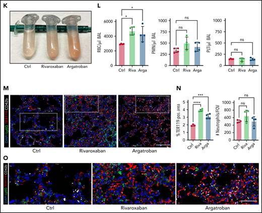 Both thrombocytopenia and anticoagulation aggravate inflammatory bleeding. (A) Experimental scheme of subacute lung injury model with or without antibody-mediated platelet depletion. The red arrow indicates antibody administration; the blue arrow indicates intranasal LPS administration. (B) Representative macroscopic images of lungs from control (C301) and thrombocytopenic animals (R300 treatment) 24 hours after LPS challenge. (C) Flow cytometric analysis of peripheral blood (platelet and RBC count) and BALF (RBC and leukocyte count/µL BALF). Student’s t test, two-tailed, unpaired. (D) Representative micrographs of immunofluorescence stainings of alveolar hemorrhage in control (C301) and thrombocytopenic animals (R300). Bar represents 100 µm. (E) Magnified excerpts of representative micrographs, corresponding to white rectangles in Figure 1D. Bar represents 50 µm. (F) Representative images of immunofluorescence stainings of lungs from control (Ctrl) or septic animals (E. coli–derived LPS 1 mg/kg BW intraperitoneally). Bar represents 100 µm (left and mid panel) and 20 µm (right panel). White arrowheads indicate fibrin(ogen)-positive platelets. Red: anti-PS antibody (Merck). (G) Quantification of fibrinogen deposition and overlap of fibrinogen/platelet positive areas. n = 3 to 4 mice per group. Student’s t test, two-tailed, unpaired. (H) Quantification of fibrinogen deposition in lungs from septic control (C301) and platelet-depleted animals (R300) per field of view (FOV). n = 4 mice per group. Student’s t test, two-tailed, unpaired. (I) Representative micrographs of control (C301) and platelet-depleted mice (R300), referring to (H). Bar represents 200 µm (left and right panels). Magnified excerpt (middle; bar represents 20 µm) corresponds to the white rectangle of the left panel. Red: anti-PS antibody (Merck). (J) Experimental scheme of (sub)acute lung injury. Bl6 mice were treated with 20 µg of LPS intranasally (blue arrow) and intravenously injected with vehicle or rivaroxaban (3 mg/kg BW) right before and 8 hours after challenge or argatroban (5 mg/kg BW) right before and 4 and 8 hours after challenge; rivaroxaban-treated animals received vehicle injections at 4 hours after challenge (red arrows indicate timing of intravenous injections). (K) Representative macroscopic image of BALF derived from 1 simultaneously performed set of experimental groups, collected in 2 mL Eppendorf tubes. The right tube corresponds to the maximum bleeding observed in argatroban-treated animals. (L) Flow-cytometric assessment of BALF (RBC, polymorphonuclear, and PLT counts/µL BALF). One-way analysis of variance (ANOVA) with Holm-Šídák's multiple comparisons test compared with control groups. (M) Representative images of immunofluorescence stainings of lung slices from different experimental groups. Bar represents 100 µm. (N) Quantification of alveolar hemorrhage (TER119+ area) and neutrophil recruitment. n = 3 to 4 mice/group. One-way ANOVA with Holm-Šídák's multiple comparisons test compared with control groups. (O) Magnified excerpts of representative micrographs, corresponding to white rectangles in Figure 1M. Bar represents 50 µm.