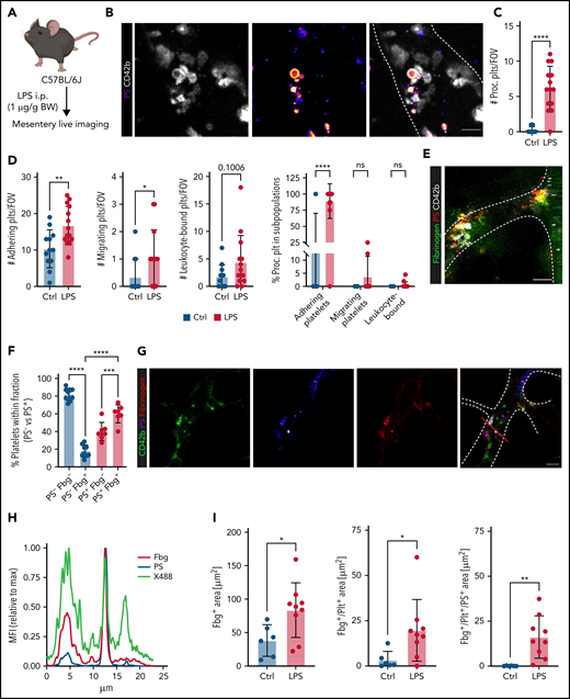 Procoagulant platelets are induced by inflammation in vivo. (A) Experimental scheme of peritoneal sepsis and mesenteric live imaging. (B) Representative images derived from 4-dimensional (4D) live microscopy of mesentery venules. Dotted lines indicate vessel walls. Bar represents 5 µm. PS staining agent: mC1. (C) Quantification of procoagulant platelets in mesenteric venules of sham- or LPS-treated Bl6 mice. Student’s t test, two-tailed, unpaired. (D) Analysis of motility patterns and quantification of procoagulant platelet content in different motility subgroups in sham- or LPS-treated animals. Student’s t test, two-tailed, unpaired. (E) Example image derived from 4D live microscopy of mesentery venules. Yellow signal indicates overlap between phosphatidylserine (PS, mC1) and fibrinogen. Dotted lines indicate vessel walls. Bar represents 10 µm. (F) Quantification of fibrinogen-binding behavior of non-procoagulant (PS-, blue) and procoagulant platelets (PS+, red) from live imaging data (n = 4 LPS-treated mice; n = 2-3 videos per mouse). Data are shown as % of all platelets of the respective subset. One-way ANOVA. (G-H) Example image derived from 4D live microscopy of mesentery venules revealing PS+, fibrinogen-binding adherent platelets. Dotted lines indicate vessel walls. The red line corresponds to the plot profiles for expression of fibrinogen, PS and CD42b (X488) as shown in (H). PS staining agent: mC1. Bar represents 20 µm. (I) Absolute quantification of the area of Fbg, Fbg/CD42b, and Fbg/CD42b/PS overlap in sham- or LPS-injected mice (n = 3-4 mice per condition; n = 2-3 videos per mouse). Student’s t test, two-tailed, unpaired. (J) Experimental scheme and representative immunofluorescence images of mesenteric venules after 4 hours of LPS intraperitoneal injection. White arrowheads indicate procoagulant platelets (CD41/GPIIBIIIA-positive, PS-positive) in close proximity to antibody-stained collagen fibers (green). Bar represents 5 µm. PS staining agent: anti-PS antibody. Refer to supplemental Figure 2N for overview images.