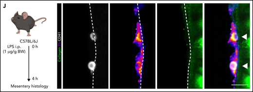 Procoagulant platelets are induced by inflammation in vivo. (A) Experimental scheme of peritoneal sepsis and mesenteric live imaging. (B) Representative images derived from 4-dimensional (4D) live microscopy of mesentery venules. Dotted lines indicate vessel walls. Bar represents 5 µm. PS staining agent: mC1. (C) Quantification of procoagulant platelets in mesenteric venules of sham- or LPS-treated Bl6 mice. Student’s t test, two-tailed, unpaired. (D) Analysis of motility patterns and quantification of procoagulant platelet content in different motility subgroups in sham- or LPS-treated animals. Student’s t test, two-tailed, unpaired. (E) Example image derived from 4D live microscopy of mesentery venules. Yellow signal indicates overlap between phosphatidylserine (PS, mC1) and fibrinogen. Dotted lines indicate vessel walls. Bar represents 10 µm. (F) Quantification of fibrinogen-binding behavior of non-procoagulant (PS-, blue) and procoagulant platelets (PS+, red) from live imaging data (n = 4 LPS-treated mice; n = 2-3 videos per mouse). Data are shown as % of all platelets of the respective subset. One-way ANOVA. (G-H) Example image derived from 4D live microscopy of mesentery venules revealing PS+, fibrinogen-binding adherent platelets. Dotted lines indicate vessel walls. The red line corresponds to the plot profiles for expression of fibrinogen, PS and CD42b (X488) as shown in (H). PS staining agent: mC1. Bar represents 20 µm. (I) Absolute quantification of the area of Fbg, Fbg/CD42b, and Fbg/CD42b/PS overlap in sham- or LPS-injected mice (n = 3-4 mice per condition; n = 2-3 videos per mouse). Student’s t test, two-tailed, unpaired. (J) Experimental scheme and representative immunofluorescence images of mesenteric venules after 4 hours of LPS intraperitoneal injection. White arrowheads indicate procoagulant platelets (CD41/GPIIBIIIA-positive, PS-positive) in close proximity to antibody-stained collagen fibers (green). Bar represents 5 µm. PS staining agent: anti-PS antibody. Refer to supplemental Figure 2N for overview images.