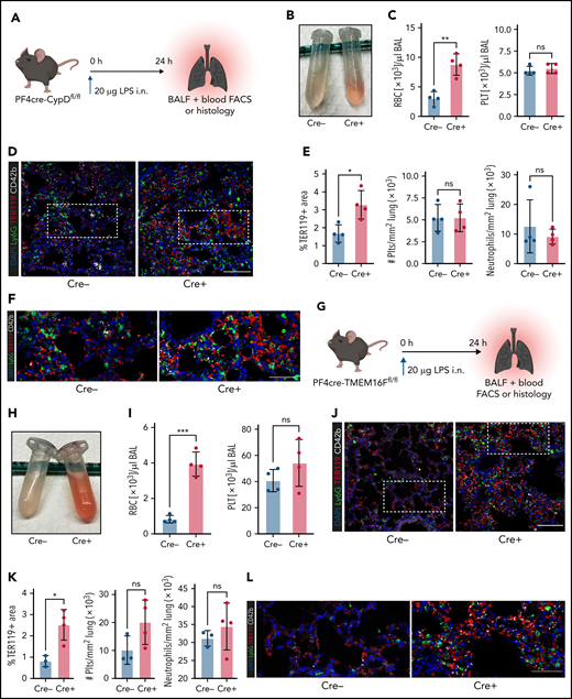 Genetic ablation of platelet PA aggravates inflammatory bleeding. (A) Experimental scheme for acute lung injury in platelet-specific CypD-knockout mice. (B) Representative image of BALF from platelet-specific CypD-knockout mice and Cre-negative littermates. (C) Flow cytometric analysis of RBC and platelet counts in BALF. Student’s t test, two-tailed, unpaired. (D) Representative micrograph of immunofluorescence-stained lung slices from CypD-knockout mice and Cre-negative control animals. Bar represents 100 µm. (E) Histological quantification of alveolar hemorrhage (TER119+ area) as well as pulmonary neutrophil and platelet recruitment. Student’s t test, two-tailed, unpaired. (F) Magnified excerpts of representative micrographs, corresponding to white rectangle in Figure 5D. Bar represents 50 µm. (G) Experimental scheme for acute lung injury in TMEM16F-knockout mice. (H) Representative image of BALF from platelet-specific TMEM16F-knockout mice and Cre-negative littermates. (I) Flow cytometric analysis of RBC and platelet counts in BALF. Student’s t test, two-tailed, unpaired. (J) Representative micrograph of immunofluorescence-stained lung slices from TMEM16F-knockout mice and Cre-negative littermates. Bar represents 100 µm. (K) Histopathological quantification of alveolar hemorrhage (TER119+ area) as well as pulmonary neutrophil and platelet recruitment. Student’s t test, two-tailed, unpaired. (L) Magnified excerpts of representative micrographs, corresponding to white rectangle in Figure 5J. Bar represents 50 µm.