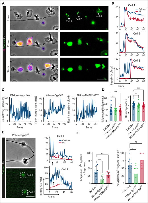 Impact of genetic and pharmacological targeting of PA pathways on platelet calcium oscillations. (A) Representative images of time-lapse microscopy of migrating human platelets and respective calcium oscillations (green) and PS exposure (annexin V, pink). PH, phase contrast. Bar represents 10 µm. White boxes indicate the area of measurement analyzed in (B). See supplemental Video 2 for corresponding live imaging. (B) Intensity projection for calcium (blue) and PS signal intensity (red) over time as % of maximum intensity for cells 1 to 3. (C) Representative calcium oscillation profiles of migrating platelets from CypD- or TMEM16F-deficient compared with platelets from PF4cre-negative animals. (D) Quantification of mean normalized calcium amplitudes and calcium peak frequency measured from mouse platelets across genotypes. n = 103 individual platelets. One-way ANOVA with Holm-Šídák's multiple comparison test. (E) Representative micrographs and calcium (blue) and PS intensity profiles (mC1, red) derived from live imaging of the 2 CypD-deficient mouse platelets indicated by white boxes. Bar represents 10 µm. Arrows indicate the beginning of contact to collagen fibers. (F) Relative quantification of percentage of supramaximal calcium peaks of all collagen-associated mouse platelets as well as relative quantification of supramaximal calcium peak-positive procoagulant platelets. Individual dots represent percentages derived from individual time-lapse microscopy videos. Platelets were isolated from n = 2 to 3 mice/group. PS staining agent: mC1. One-way ANOVA with Holm-Šídák's multiple comparisons test.