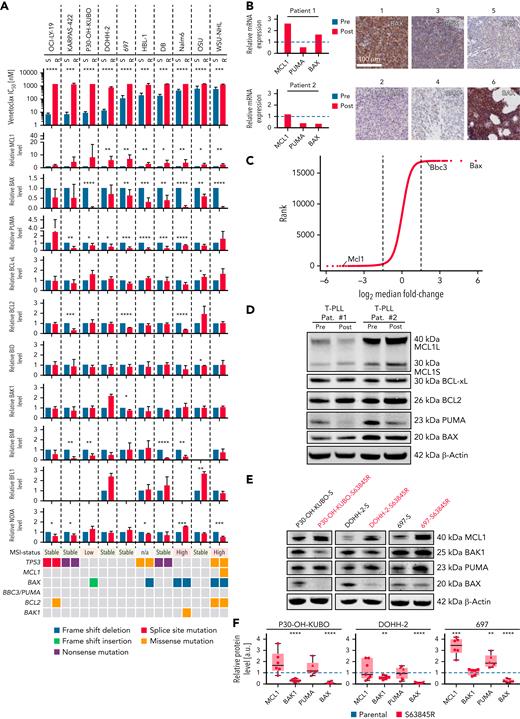 Downregulation of BAX and PUMA and upregulation of MCL-1 in vitro and in vivo. (A) Top: IC50 values for VEN in 10 sensitive (blue) vs VEN-resistant (red) B-cell lymphoma cell lines: WSU-NHL, OCI-LY-19, DOHH-2, DB, KARPAS-422, HBL-1, 697, P30-OH-KUBO, Nalm6, and OSU. Middle: densitometric analyses of immunoblots of BCL2 proteins (supplemental Figure 1A-B). Mean ± SD of at least 3 independent experiments. ∗P < .05; ∗∗P < .01; ∗∗∗P < .001, compared with parental (VEN naïve) cells, Students t test. Lower: results from WES. Genomic alterations are annotated according to the color panel below the image. (B) Immunohistochemistry of BAX in 6 primary CLL samples. Scale bar, 100 μm. Pictures 1 through 5: lymph node sections posttherapy; picture 6: bone marrow post–VEN therapy. Relative MCL1 (left panel) and BBC3 (PUMA) (right panel) and BAX mRNA expression level for CLL patients 1 and 2 pre- (blue) and post (red)-VEN therapy determined by bulk 3′RNA-seq. (C) Results for Bax, Bbc3, and Mcl1 guide RNAs from CRISPR/Cas9-Screen in murine lymphoma cell line after 28 days with/without VEN (10 nM). (D) Immunoblot for MCL1, BCL-xL, BCL2, PUMA, and BAX in 2 T-PLL patients before and after VEN resistance. (E) Immunoblot for MCL1, BAK1, PUMA, and BAX in 3 sensitive and S63845-resistant B-cell lymphoma cell lines, respectively. (F) Densitometric analyses of immunoblots against MCL1, BAK1, PUMA, and BAX normalized to β-actin. Data illustrated as mean ± SD of at least 3 independent experiments. ∗P < .05; ∗∗P < .01; ∗∗∗P < .001; ∗∗∗∗P < .001, compared with parental (blue) cells, Student t test. 3′RNA-seq, 3’RNA-sequencing; IC50, median inhibition concentration.