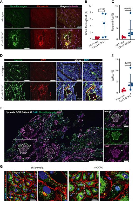 CCM lesions are procoagulant in vivo. (A) Representative images of the cerebellum of wild-type (upper panel) and Ccm3-iECKO (lower panel) P8 mice stained with fibrin-fibrinogen (green), fibronectin (red), and isolectin (magenta). Colocalization of fibrin-fibrinogen and fibronectin is highlighted with an arrow. (B) Quantification of fibrin-fibrinogen in the cerebellum (cb) of wild-type and Ccm3-iECKO mice (P = .0556). (C) Quantification of fibronectin in the cerebellum (cb) of wild-type and Ccm3-iECKO mice (P = .0079). (D) Representative images of the cerebellum of wild-type (upper panel) and Ccm3-iECKO (lower panel) P8 mice stained with isolectin (green), VWF (red), and DAPI (blue). A magnified image is shown in the right panel and the asterisks highlight secreted VWF. (E) Quantification of VWF in the cerebellum (cb) of wild-type and Ccm3-iECKO mice (P = .0159). (F) A tile scan of a sporadic CCM patient biopsy with multiple lesions. DAPI (blue) highlights the nuclei of cells, fibrin-fibrinogen (green) highlights leakage and clots and VWF (magenta) outlines the vasculature and fills clots. A selected region (dashed box) is shown to the right and it demonstrates a large clot filled fibrin (green) and VWF (magenta). Fibrin and VWF colocalize in the clot (merged panel on the top right). (G) Confluent HBECs (shScramble, left and shCCM3, right) stained for VWF (green) VE-cadherin (red), and DAPI (blue). High magnification (zoom) images on the right side of each condition. Arrows represent VWF strings. In all graphs, each data point represents 1 biological replicate (n = 4-8 mice per group), the bar indicates the mean of each group, and the error bars represent the standard deviation. A Mann-Whitney U test was used to compare wild-type mice with Ccm3-iECKO mice; the corresponding P values are indicated on each graph.