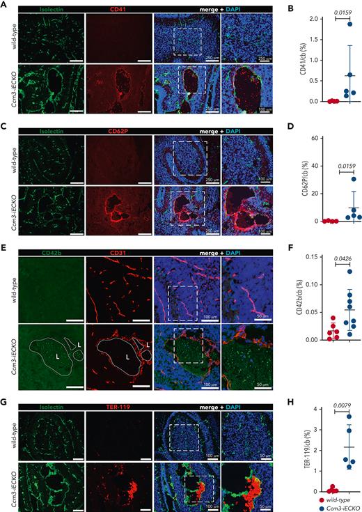 The endothelium of Ccm3-iECKO mice is activated and procoagulant. (A) Representative images of the cerebellum of wild-type (upper panel) and Ccm3-iECKO (lower panel) P8 mice stained with isolectin (green), CD41 (red), and DAPI (blue). A magnified image is shown in the right panel. (B) Quantification of CD41 in the cerebellum (cb) of wild-type and Ccm3-iECKO mice (P = .0159). (C) Representative images of the cerebellum of wild-type (upper panel) and Ccm3-iECKO (lower panel) P8 mice stained with isolectin (green), CD62P (red), and DAPI (blue). A magnified image is shown in the right panel. (D) Quantification of CD62P in the cerebellum (cb) of wild-type and Ccm3-iECKO mice (P = .0159). (E) Representative images of the cerebellum of wild-type (upper panel) and Ccm3-iECKO (lower panel) P8 mice stained with CD42b (green), CD31 (red), and DAPI (blue). A magnified image is shown in the right panel. (F) Quantification of CD42b area in the cerebellum (cb) of wild-type and Ccm3-iECKO mice (P = .0426). (G) Representative images of the cerebellum of wild-type (upper panel) and Ccm3-iECKO (lower panel) P8 mice stained with isolectin (green), TER-119 (red), and DAPI (blue). Merged image (left panel) shows TER-119-positive cells attached to the vessel wall in Ccm3-iECKO mice. (H) Quantification of TER-119 in the cerebellum (cb) of wild-type and Ccm3-iECKO mice (P = .0079). In all graphs, each data point represents 1 biological replicate (n = 4-8 mice per group), the bar indicates the mean of each group, and the error bars represent the standard deviation. A Mann-Whitney U test was used to compare wild-type mice with Ccm3-iECKO mice; the corresponding P values are indicated on each graph.