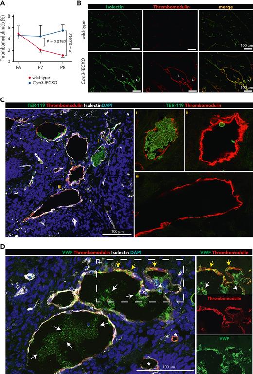 Thrombomodulin is expressed in a heterogeneous manner in Ccm3-iECKO mice. (A) Kinetic expression of thrombomodulin at P6, P7, and P8 in the cerebellum (cb) shows that thrombomodulin expression decreased in wild-type mice (red line) but remained high in Ccm3-iEKO mice (blue line). Thrombomodulin was significantly higher in Ccm3-iEKO at P7 (P = .0190). and P8 (P = .0043) when compared with wild-type mice. (B) Representative images of the cerebellum of wild-type (upper panel) and Ccm3-iECKO (lower panel) P8 mice stained with isolectin (green) and thrombomodulin (red). A merged image is shown in the right panel. (C) Images of the heterogeneous expression of erythrocytes (green) and thrombomodulin (red) show how (i) lesions filled with erythrocytes have a lower expression of thrombomodulin, whereas lesions that are hallowed (ii) and (iii) have a high expression of thrombomodulin. (D) Images showing the heterogeneous expression of VWF (green) and thrombomodulin (red) showing how some regions express high levels of vascular and extracellular VWF with thrombomodulin (dashed box, split channels to the right), and other vessels express low levels of VWF (asterisks). White arrows highlight secreted VWF, and yellow arrows highlight thrombomodulin/VWF colocalization. In panel A, the mean of n = 12 mice in each group are shown. Bars indicate the standard deviation in each group. A Mann-Whitney U test was used to compare wild-type mice with Ccm3-iECKO mice; the corresponding P values are indicated on each graph.