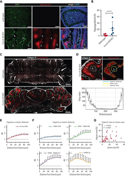 CCM lesions are surrounded by hypoxia; more and larger lesions result in a hypoxic parenchyma. (A) Representative image of wild-type (upper panel) and Ccm3-iECKO (lower panel) P8 cerebellum sections: vessels are stained with CD31 (green), a marker of hypoxia (Hypoxyprobe, red), and DAPI (blue). Merged images (right panel) show that hypoxia appears in the periphery of the lesions. (B) Quantification of the hypoxic area in the cerebellum (cb) of wild-type and Ccm3-iECKO mice (P = .0173). A Mann-Whitney U test was used to compare the 2 groups. Each point represents 1 biological replicate (n = 5-6 mice per group), the bar indicates the mean of each group, and the error bars represent the standard deviation. (C) Representative images of CLARITY-treated cerebellums of wild-type (upper) and Ccm3-iECKO (lower) mice stained with a marker of hypoxia (Hypoxyprobe, red), and collagen IV (white). (D) A magnified region of the dashed green square marked in panel C, illustrating how hypoxia and lesion distance were measured. The left panel shows hypoxia surrounding a lesion in 1 cerebellar lobe. Collagen IV is used to mark the vasculature. The right panel shows how lesion area, hypoxic area, and hypoxic distance were measured and the graph below shows the fluorescence intensity of hypoxia (gray value) after the hypoxic distance in micrometers was measured across the lesion. (E) Hypoxia intensity increases with distance from the lesions. Hypoxia intensity is shown as AU, which were determined by dividing the fluorescence intensity surrounding the lesions by the fluorescence intensity at the perimeter of the same lesions. Mean hypoxia intensity and lesion distance were determined for a total of 262 lesions from 3 Ccm3-iECKO mice. (F) The lesions were grouped by size (i-iv). The number of analyzed lesions in each group is indicated in parenthesis on the upper right corner of each graph. Data are shown as mean with 95% confidence intervals. (G) A total of 37 parts of the cerebellum (∼750 × 750 μm), such as in the lower image of panel C, were randomly selected from 5 sections of 3 Ccm3-iECKO mice and were evaluated for lesion size and hypoxic area. A correlation analysis was done between hypoxic area and lesion area. The Spearman correlation coefficient (r = 0.5339) and the corresponding P value (P = .0007) are indicated on the plot.