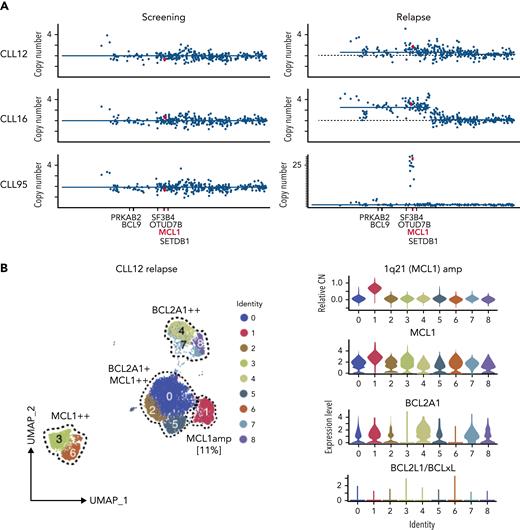 Increased MCL1 expression at VEN relapse is only partially explained by amplification of the MCL1 gene. (A) Representation of the gained genomic regions in the 1q locus across the screening and relapsed samples from CLL12, CLL16, and CLL95 analyzed by WES. MCL1 is highlighted in red. Gray dotted lines indicate CN of 2. Blue lines indicate CN inferred from WES data. (B-D) UMAP projections (left) of CLL cells from (B) CLL12, (C) CLL16, and (D) CLL95 at relapse, with violin plots (right panels) showing inferred CN variation of 1q21 (MCL1) or relative expression of indicated prosurvival genes across the individual clusters. (E) Histograms showing mass cytometric analysis of MCL1 protein expression in viable (cisplatinlo) CD5+veCD19+ve PBMCs from screening samples from CLL16 (blue), relapsed samples from CLL16, CLL12, and CLL95 (all red). (F) PBMCs prepared at VEN-relapse were incubated in vitro for 24 hours with 0 to 4 μM S63845 (MCL1i). Viability (PI-ve) was measured in CLL cells (CD5+veCD19+ve), and data points represent the mean ± standard deviation of triplicate measurements in single experiments. CLL95 displayed marked sensitivity to MCL1i (LC50 10nM), while CLL12 and CLL16 had modest sensitivity (LC50s ∼600nM and ∼2700nM, respectively).