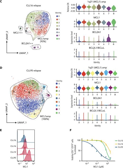 Increased MCL1 expression at VEN relapse is only partially explained by amplification of the MCL1 gene. (A) Representation of the gained genomic regions in the 1q locus across the screening and relapsed samples from CLL12, CLL16, and CLL95 analyzed by WES. MCL1 is highlighted in red. Gray dotted lines indicate CN of 2. Blue lines indicate CN inferred from WES data. (B-D) UMAP projections (left) of CLL cells from (B) CLL12, (C) CLL16, and (D) CLL95 at relapse, with violin plots (right panels) showing inferred CN variation of 1q21 (MCL1) or relative expression of indicated prosurvival genes across the individual clusters. (E) Histograms showing mass cytometric analysis of MCL1 protein expression in viable (cisplatinlo) CD5+veCD19+ve PBMCs from screening samples from CLL16 (blue), relapsed samples from CLL16, CLL12, and CLL95 (all red). (F) PBMCs prepared at VEN-relapse were incubated in vitro for 24 hours with 0 to 4 μM S63845 (MCL1i). Viability (PI-ve) was measured in CLL cells (CD5+veCD19+ve), and data points represent the mean ± standard deviation of triplicate measurements in single experiments. CLL95 displayed marked sensitivity to MCL1i (LC50 10nM), while CLL12 and CLL16 had modest sensitivity (LC50s ∼600nM and ∼2700nM, respectively).