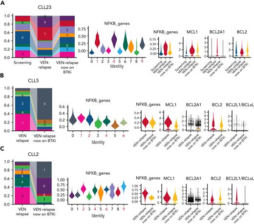 Altered transcriptional profiles at relapse dissipate after cessation of VEN therapy. (A) Bar plots (left) showing the proportion of CLL cells for each cluster (supplemental Figure 9A) from CLL23 samples collected at screening, after relapse while on VEN, and after subsequently switching to BTKi. Violin plots (middle; NF-κB high clusters marked in red) showing the expression of NF-κB genes for each cluster are shown on the left. Violin plots (right) showing NFKB genes, MCL1, BCL2A1, or BCL2 expression at different treatment stages for CLL23. (B-C) Bar plots (left) showing the proportion of CLL cells for each cluster (supplemental Figure 9B-C) from (B) CLL5 or (C) CLL2 samples collected at relapse while on VEN and after subsequently switching to BTKi. Violin plots (middle) showing the expression of NF-κB genes for each cluster are shown on the left. Violin plots (right) showing NFKB genes, MCL1, BCL2A1, BCL2, or BCLxL expression at different treatment stages for (B) CLL5 or (C) CLL2.