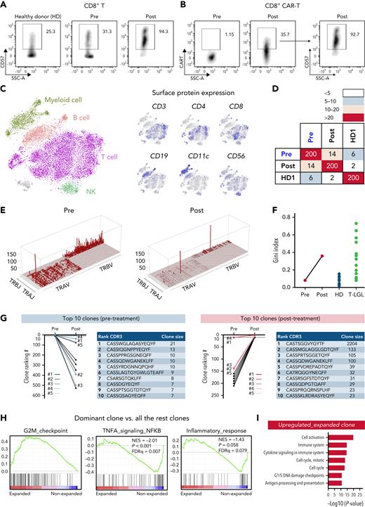 Oligoclonal T-cell expansion in a CAR T-cell–treated patient with acquired BM deficiency. (A) Expression of CD57 in CD8+ T cells in pretreatment and posttreatment samples and in an HD control. (B) Expression of the CAR construct in CD8+ T cells in pretreatment and posttreatment samples (left), and expression of CD57 in CD8+ CAR T cells (right). (C) t-SNE plot of single-cell gene expression in PBMCs of pretreatment and posttreatment samples. Cells formed graph-based clusters based on transcriptome similarity and cell types were assigned to cell clusters (left). Expression of well-established surface markers (CD3, CD4, CD8, CD19, CD11c, and CD56) in top 20% cells were highlighted on the same t-SNE plot (right). (D) A heat map plot showing the number of shared CDR3 sequences among top 200 TCR clones of pretreatment and posttreatment samples. On both x-axes and y-axes, samples of the patient and HD are depicted; paired samples (pretreatment and posttreatment) are adjacent. Numbers indicate counts of identical T-cell receptor (TCR) clones shared among samples. The color scheme (red to light blue) indicates the number of shared TCR CDR3 sequences from high to low. (E) Skyscraper plots showing for Vβ/Vα and matching Jβ/Jα in pretreatment and posttreatment samples. (F) Gini index of TCR clone size distribution was compared in pretreatment and posttreatment samples and with reported HDs and patients with T-LGLL.17 (G) Ranking of the top 10 TCR clonotypes from pretreatment and posttreatment samples. Blue lines indicate the top 5 clones before treatment; red lines indicate the top 5 clones after treatment. CDR3 sequences and clone sizes (cell count) of top 10 clones in pretreatment and posttreatment samples are depicted to the right of the graph, respectively. (H) GSEA plots of differentially expressed genes of the dominant clone vs all the other clones in posttreatment samples. (I) Bar plot showing top upregulated pathways in the dominant clone of the posttreatment sample as analyzed by Genomatix using top differentially expressed genes. t-SNE, t-distributed stochastic neighbor embedding.