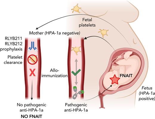 Prophylactic administration of human HPA-1a–specific antibodies protects against FNAIT in mice. In FNAIT, HPA-1a–positive fetal platelets enter the maternal circulation, resulting in maternal alloimmunization characterized by the development of pathogenic HPA-1a alloantibodies. These antibodies cross the placenta and destroy the fetal platelets, causing thrombocytopenia and bleeding symptoms in the fetus or newborn (right side). Prophylactic administration of RLYB211 (polyclonal antibody) or RLYB212 (monoclonal antibody) rapidly clears HPA-1a–positive platelets and prevents maternal alloimmunization (development of pathogenic HPA-1a alloantibodies) and subsequent onset of FNAIT in an alloantigen-specific FNAIT mouse model (left side). This provides support for use of a similar approach to prevent FNAIT in humans. Figure was created with BioRender.com.