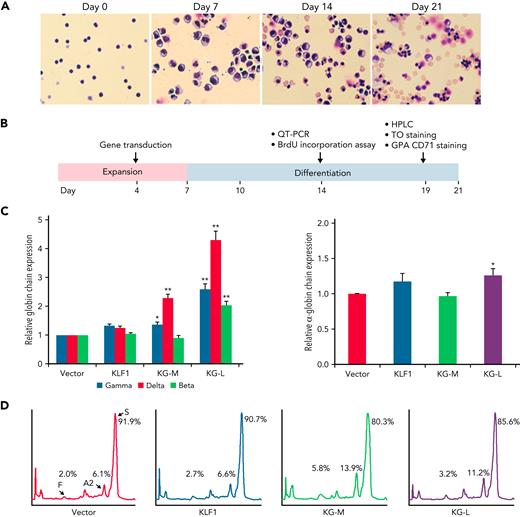 KLF1-GATA1 fusion protein upregulates δ-globin gene and HbA2 expression in erythroid cells cultured from human CD34+ sickle cells. Human CD34+ sickle cells were lentivirus transduced with vector only, KLF1, or KLF1-GATA1 fusion protein, then grown in an erythroid culture system for 3 weeks. (A) Cultured cells stained with Giemsa showing erythroid differentiation progression from erythroblast to normoblast at days 7 and 14 to a mostly uniform population of enucleated reticulocytes and erythrocytes at day 21. Original magnification, ×40. (B) Experimental schema, with the time course of expansion and differentiation phases indicated. Time points are indicated for the specific analyses (C) Quantitative-PCR (QT-PCR) analysis of globin-chain gene expression in cultured erythroid cells. ∗P < .05, ∗∗P < .01 vs vector control-transduced cells. Error bars represent the mean ± standard deviation (SD) of 3 independent experiments. (D) HPLC analysis of HbA, HbA2, and HbF expression in cultured erythroid cells. At least 3 independent experiments were performed. HPLC, high performance liquid chromatography; KG-M, medium-form KLF1-GATA1; KG-L, long-form KLF1-GATA1.