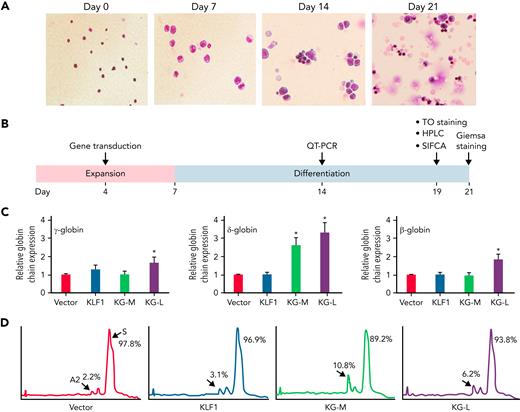 KLF1-GATA1 fusion protein upregulates δ-globin gene and HbA2 expression in erythroid cells cultured from SCD mouse HSCs. Sca-1+c-Kit+Lin/low HSCs isolated from SCD mice were transduced with vector only, KLF1, or KLF1-GATA1 fusion protein, then grown in an erythroid culture system for 3 weeks. (A) Giemsa staining at the cell-culture time points indicated, showing the progression of erythroid differentiation from HSCs to enucleated reticulocytes and erythrocytes. Original magnification, ×40. (B) The time course of expansion and differentiation phases. Time points are indicated for the specific analyses conducted. (C) Quantitative-PCR (QT-PCR) analysis of globin-chain gene expression in cultured erythroid cells. ∗P < .05, ∗∗P < .01 vs vector control–transduced cells. Error bars indicate the mean ± SD results of 3 independent experiments. (D) Representative HPLC analysis of HbA2 expression in cultured erythroid cells. At least 3 independent experiments were performed. HPLC, high performance liquid chromatography; KG-M, medium-form KLF1-GATA1; KG-L, long-form KLF1-GATA1.