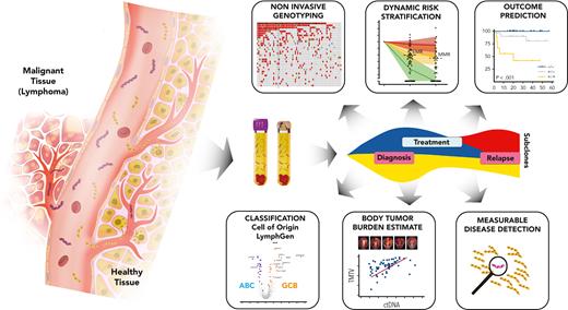 Applications of ctDNA in lymphoma. Schematic illustrates the potential applications of liquid biopsy assessment, as used for the identification of clinically actionable adverse-risk features in lymphomas at different disease milestones. A lymphoid tumor (left of vessel) is imagined as being accessible through blood plasma by analysis of ctDNA fragments. ctDNA is represented by purple double-stranded DNA molecules, and yellow double strands represent non–tumor-derived cell-free DNA molecules. The patient is evaluated by ctDNA profiling during various disease milestones over time (diagnosis, treatment, and relapse).488 During this temporal sequence, ctDNA can inform risk at diagnosis, during therapy, immediately after induction therapy, in surveillance of disease, and at progression or disease transformation,424 as illustrated in the panels associated with each milestone. At diagnosis, profiling of tumor DNA obtained from either tissue biopsies or noninvasively through genotyping of plasma (depicted as blood collection tubes),24 allows for the identification of patients with high tumor burden,246,421 histological subtypes,489 and prediction of outcomes.422 Assessment of ctDNA during and after lymphoma treatment facilitates the detection of both emerging resistance mutations and MRD before progression,419 with potential for noninvasive prediction of relapse and transformation.490 Tumor evolution in an anecdotal patient with DLBCL is illustrated, showing tumor response and clonal evolution over the course of the disease (detectable subclones at diagnosis are shown in blue/yellow; an emergent subclone after therapy is shown in red). EMR, early molecular response; MMR, major molecular response; TMTV, total metabolic tumor volume.
