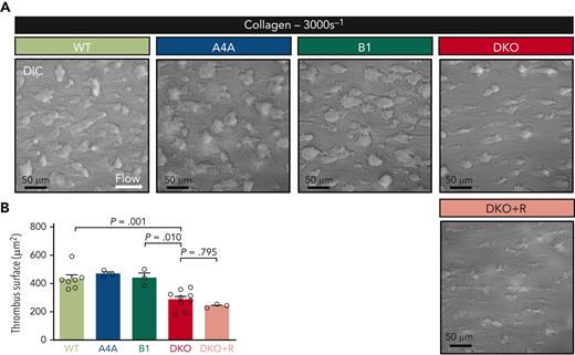 Platelet aggregates formation onto type I collagen matrices under flow is impaired in the absence of α4A- and β1-tubulins. (A) Representative DIC micrographs of aggregates formed after perfusion of hirudinated blood of WT, KOA4A (A4A), KOB1 (B1), DKO, and romiplostim-treated DKO (DKO+R) mice for 105 seconds at 3000 reciprocal seconds (s-1) into type-I collagen-coated (200 μg/mL) polydimethylsiloxane channels. Scale bar, 50 μm. (B) Bar graph representing the mean surface ±SEM of WT, KOA4A (A4A), KOB1 (B1), and DKO mice and romiplostim-treated DKO aggregates formed under the same condition. Results are expressed in μm2. Each symbol indicates an individual flow. N ≥ 3 per group, with at least 250 aggregates counted per individual flow. Statistical analysis was conducted by 1-way ANOVA followed by Tukey HSD post-hoc test.