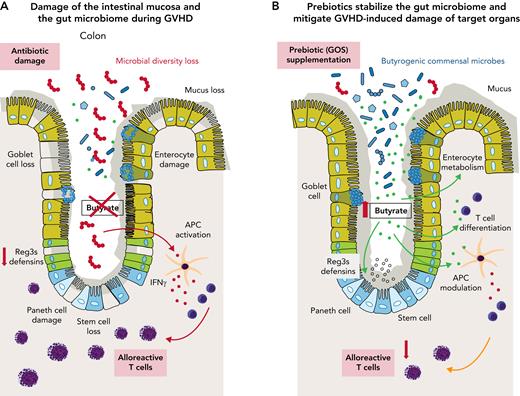 The panels show one concept of GVHD prevention and/or therapy by prebiotic stabilization of the gut microbiome. (A) GVHD-associated disruption of gut mucosa homeostasis that is (partly) fueled by antibiotic-induced microbiome damage. (B) GOS prebiotics enhance the metabolic capacity of the microbiome to produce more butyrate and other SCFAs that can modulate alloreactivity and inflammatory processes in the allo-HCT recipient. APC, antigen-presenting cell; IFNγ, interferon-gamma.