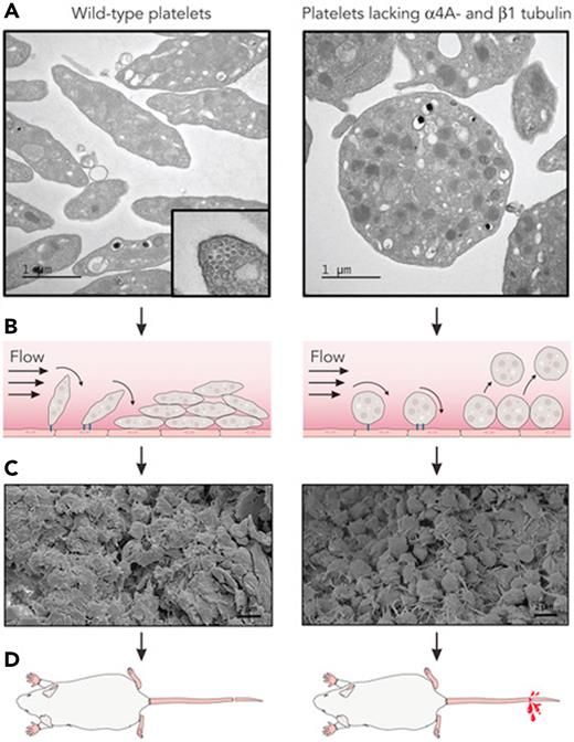 Discoid shape promotes durable thrombi. (A) Platelets that lack α4A-and β1-tubulin demonstrate a spherical morphology and lack the microtubule-derived marginal band, a cross-section of which is shown in the left panel. (B) Under flow conditions, the discoid shape of wild-type platelets provides an increased surface area for attachment to the vessel wall (black line) and to each other. By comparison, spherical platelets form looser attachments that are prone to give way to flow. (C) As a result, thrombi formed by discoid platelets are more compact. (D) The friability of thrombi formed by spherical platelets results in increased bleeding. (Electron micrographs were extracted from their original Figures 1 and 3 in Kimmerlin et al that begins on page 2290. Professional illustration by Patrick Lane, ScEYEnce Studios.)
