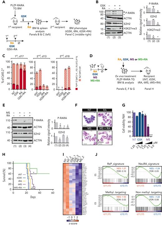 Impact of targeting EZH2 on APL progression. (A) Experimental scheme of the analysis of RA, GSK, or combination-treated BM. PLZF-RARA TG BM is transplanted into recipient mice. Seven days after, mice are injected for 3 days with GSK or with corn oil (NT) followed by 7 consecutive days of RA (RA). After treatments (NT: corn oil, GSK, RA, GSK and RA) mice are sacrificed, and treated BM are immunophenotyped and reinjected into new recipient mice (tNT, tGSK, tRA, tGSK+RA). At this time treatments are stopped (Ø). Mice are sacrificed 15 to 20 days after the secondary transplantation. (B) (Left) Global levels of PLZF-RARA (black arrow: full length, black star: degraded form), Ezh2, and H3K27me3. Actin is used as loading control. (Right) Bar plots representing the signal intensity of PLZF-RARA (P-RARA), EZH2, and H3K27me3 normalized to the loading control and to the NT condition. ∗P < .05 (3 biological replicates). (C) (Left) Impact of GSK, RA, and combo treatments on PLZF-RARA leukemia at day 17 after the first transplantation (NT, GSK, RA, GSK+RA). (Middle and right) Evaluation of leukemia relapse monitored by FACS analysis (Cd45.2, Cd11b, and Gr1 markers are monitored) at day 13 (d13) and day 18 (d18) after the secondary transplantation (tNT, tGSK, tRA, tGSK+RA). (D) Scheme resuming the protocol to evaluate the effect of MS treatment on PLZF-RARA BM. (E) (Left) Global levels of PLZF-RARA and Ezh2 after RA (0.1 μM) and/or MS (1.25 μM) treatments. Actin is used as loading controls. (Right) Bar plots representing the signal intensity of PLZF-RARA (P-RARA) and EZH2 normalized to the loading control and to the NT condition. ∗P < .05 (2 biological replicates). (F) Cell morphology analyzed by MGG staining (magnification 64×; bar 20 μm). (G) Cell viability of PLZF-RARA TG cells upon GSK or MS treatments monitored by bioluminescence. Results are expressed by percent of living cells and normalized to the untreated condition (NT). Results are expressed as the mean standard deviation of 3 independent experiments (n = 3). ∗P < .05, ∗∗∗P < .001. (H) Survival rate of mice transplanted with untreated (tNT, gray curve, 8 mice) GSK (tGSK, 2.5 μM, blue curve, 5 mice), RA (tRA, 0.1 μM, 5 mice), MS (tMS, 2.5 μM, purple curve, 10 mice), MS and RA (tMS+RA, 1.25 μM MS and 0.1 μM RA, green curve, 5 mice) pretreated PLZF-RARA TG BM. ∗P < .05, ∗∗P < .01. (I) RNA-seq (2 biological replicates) performed on promyelocytes purified from PLZF-RARA TG mice and treated or not (NT) with MS (MS, 2.5 μM), or GSK (2.5 μM) (in vitro treatments). Impact of MS (MS) and GSK on the expression of the most differentially overexpressed genes in the ReP cluster compared with the other clusters. Results are expressed as gene counts z score. (J) Gene set enrichment analysis of t(11;17) APL patients (PLZF-RARA) compared with t(15;17) APL patients (PML-RARA). ReP, NeuRA, the targeting of nonmethyltransferase activities of EZH2 (Non methyl.targeting) and the targeting of methyltransferase activities of EZH2 (Methyl. targeting) enrichment signatures (ESs) are computed. FDR, false discovery rate; NES, normalized enrichment score.