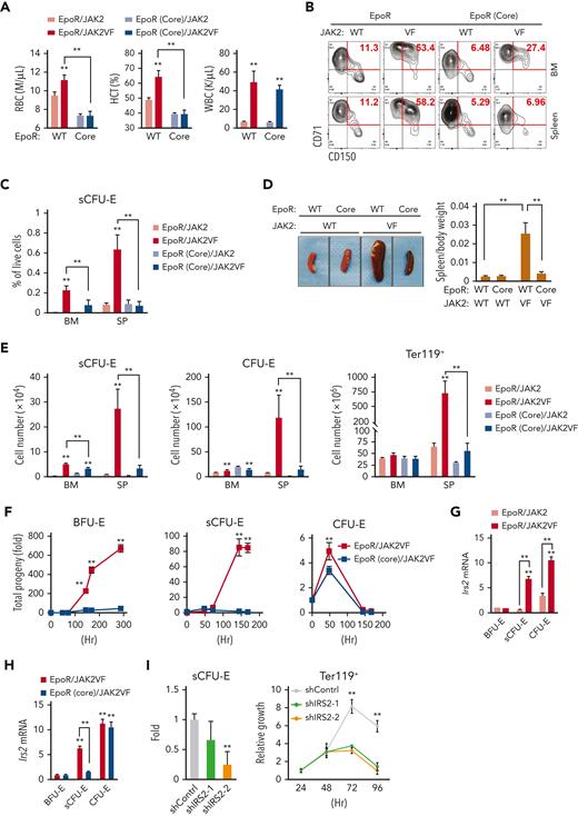Impaired sCFU-E expansion prevents JAK2(V617F)-driven erythrocytosis in MPN. (A) Blood cell counts in transplanted mice expressing EpoR or EpoR(core) together with JAK2 or JAK2(V617F) 3 months after transplantation. (B-C) JAK2(V617F)-driven sCFU-E expansion is defective in transplant-recipient mice expressing EpoR(core). Representative flow plots are shown in (B) and quantifications in (C). (D) Expression of EpoR(core) prevents JAK2(V617F)-induced splenomegaly in JAK2(V617F)KI mice. (E) The numbers of sCFU-E, CFU-E, and Ter119+ cells are reduced significantly in EpoR(core)/JAK2(V617F)KI mice compared with EpoR/JAK2(V617F)KI mice. (F) Sorted BFU-E and sCFU-E cells from EpoR(core)/JAK2(V617F)KI mice fail to generate Ter119+ progenies in vitro. Cells were cultured in media with SCF, but devoid of Epo. (G) In mice expressing wild-type (WT) EpoR, JAK2(V617F) increases IRS2 messenger RNA (mRNA) expression in sCFU-E and CFU-E cells. (H) IRS2 mRNA expression is reduced significantly in sCFU-E cells from EpoR(core)/JAK2(V617F) mice. (I) IRS2 knockdown inhibits sCFU-E and erythroid progeny growth in vitro. GFP+ cells are gated for analyses. sCFU-E fold changes are normalized to shControl, and the relative growth of Ter119+ cells are normalized to cell numbers at 24 hours. BM, bone marrow; HCT, hematocrit; SP, spleen; VF, JAK2(V617F); WBC, white blood cell. ∗P < .05, ∗∗P < .01, 2-way ANOVA.