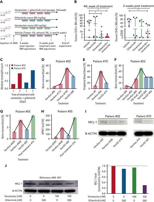 Primary AML from patients with venetoclax-azacitidine–refractory disease respond to venetoclax-gilteritinib in vitro and in vivo. (A) Overview of PDX model experiment. Treatment with gilteritinib (n = 5 mice), venetoclax (n = 5 mice), combination of both (n = 5 mice), or vehicle (n = 4 mice) started 3 weeks postinjection and lasted 4 weeks. Two weeks after end of treatment, mice were euthanized, and bone marrow (BM) was analyzed. (B) Percentage of CD45+ cells in BM obtained from PDX-transformed mice in the fourth week of treatment (left) or after euthanasia (right). (C) Absolute neutrophil count for patients 02 and 70 upon treatment with venetoclax-gilteritinib. (D-G) Percentage of BM (D, F, G) or peripheral blood (E) blasts of 4 venetoclax-azacitidine–refractory patients treated with venetoclax-gilteritinib. Blast percentage was analyzed at indicated time points upon start of the respective treatment condition. (H) Percentage of NPM1 level of patient 05. NPM1 level was analyzed at indicated time points upon start of the respective treatment condition. (I) Blasts from patients 02 and 70 obtained at different stages of therapy were lysed and analyzed for levels of MCL-1 and B-actin. (J) Primary AML blasts from patient 01 were treated for 12 hours with 100 nM of venetoclax, 500 nM of gilteritinib, or the combination of both. MCL-1 and B-actin levels were detected by western blotting and compared with untreated cells. ∗P < .05.