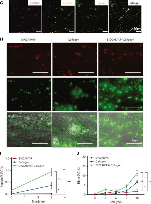 S100A8/A9 accelerates the recruitment of annexin-V–positive platelets and fibrin generation at a venous shear rate. (A-C) Plasma levels of S100A8/A9 were measured by ELISA in healthy donors and patients with uncomplicated and complicated (ICU survivors/nonsurvivors) COVID-19 over 7 consecutive days after inclusion in the study. (A) S100A8/A9 levels in the plasma of healthy donors (control, n = 10), uncomplicated COVID-19 patients (n = 48), ICU survivors (n = 26), and ICU nonsurvivors (n = 13) on the first day of patient inclusion in the study. (B-C) S100A8/A9 levels in the plasma over 7 consecutive days after patient recruitment. (D-G) Representative immunofluorescence staining of lung autopsies obtained from COVID-19 patients or age-matched control. Images were captured using Epi fluorescence microscope and slide scanner Axioscan Z1. (D) Platelet CD42b and heterodimeric S100A8/A9 staining in lung parenchyma and microcirculation in COVID-19 and control lung autopsies. (E) Staining for S100A8/A9, MPO, and nuclei (DAPI) of a large vessel in the lung of a patient with COVID-19 with thrombotic complications. (F) Staining for platelet CD42b, fibrin, and nuclei (DAPI) in large thrombi of a patient with COVID-19. (G) S100A9, CD42b, and fibrin staining in COVID-19 lung. Arrow shows platelet-fibrin microaggregates. (H) Whole blood under recalcified conditions was perfused at a venous shear rate (100 s−1) over S100A8/A9 (40 μg/mL), collagen (100 μg/mL), or combination of S100A8/A9 and collagen-coated chambers. The presence of PS-positive platelets and fibrin were assessed using annexin-V-Alexa Fluor-647 and FITC-anti-fibrinogen/fibrin antibody, respectively. (H) Representative images taken at 15 minutes. (I) Quantification of annexin-V signal (3 minutes) (n = 5) and (J) fibrin signal time course (0-15 minutes) (n = 5) using predefined semiautomated scripts in Fiji as detailed in the supplemental Methods (available on the Blood website). Results are shown as mean ± standard error of the mean (SEM). The statistical significance was analyzed using two-way ANOVA with Tukey’s multiple comparison test between all groups. ∗P < .05, ∗∗P < .005, ∗∗∗P < .001, ∗∗∗∗P < .0001.