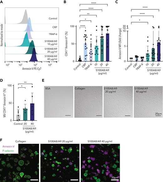 S100A8/A9 induces the formation of procoagulant platelets. Human washed platelets (106 platelets/condition) were incubated with different concentrations of S100A8/A9 (10, 20 and 40 μg/mL) for 30 minutes at 37°C. (A-C) PS exposure was determined by flow cytometry using PE-Cy7–labeled annexin-V (n = 17). CRP (10 μg/mL) and TRAP-6 (100 μM) were used as positive control. (A) Representative histogram for annexin-V staining. Representative histograms normalized to mode (each peak normalized to its mode for each condition). (B) Percentage of CD41+annexin-V+ platelets. (C) Fold change in the mean fluorescent intensity (MFI) of agonist-activated platelets over control. (D) The percentage of CD41+MVs positive for annexin-V (n = 6). (E-F) Human washed platelets spreading on collagen or S100A8/A9. Representative differential interference contrast (DIC) images of spread platelets. (F) Representative annexin-V (magenta) and P-selectin (green) staining for adherent platelets. (G) Quantification of annexin-V–positive, P-selectin–positive, or annexin-V and P-selectin–double positive platelets adherent on collagen and S100A8/A9 (positive platelets/total platelets). The statistical significance was analyzed using two-way ANOVA with Tukey’s multiple comparison test between all groups. (H-I) Assessment of intracellular Ca2+ release from platelets spread over surfaces coated with S100A8/A9 (20 and 40 μg/mL), fibrinogen, or bovine serum albumin assessed using BAPTA-1-AM Ca2+ sensitive dye. (H) Representative Ca2+ traces assessed using Oregon Green-488 BAPTA-1-AM. (I) Peak fluorescence at time point zero (F0/Fmax). Data are shown as mean ± SD. The statistical significance was analyzed using a nonparametric test (Kruskal-Wallis test). ∗P < .05, ∗∗P < .005, ∗∗∗P < .001, ∗∗∗∗P < .0001.