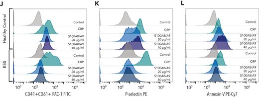 Recombinant human GPIbα blocks platelet response to S100A8/A9, whereas Bernard-Soulier syndrome platelets failed to respond to S100A8/A9. Washed human platelets (106 platelets/condition) were incubated with S100A8/A9 (40 μg/mL) in the absence or presence of recombinant human GPIbα (rGPIbα; 1.7 μM) for 30 minutes at 37°C (n = 3). Platelet activation was assessed by flow cytometry using (A-C) anti–P-selectin, (D-F) PS exposure using annexin-V, and (G-I) GPIIb/IIIa activation using PAC-1 antibody. Human washed platelets from a healthy donor or a Bernard-Soulier syndrome patient were incubated with S100A8/A9 (20 and 40 μg/mL) for 30 minutes at 37°C (J-L). CRP (10 μg/mL) was used as positive control. (J) GPIIb/IIIa activation, (K) P-selectin, and (L) PS exposure were measured. The statistical significance was analyzed using one-way ANOVA. Data presented as mean ± SEM. ∗P < .05, ∗∗P < .005, ∗∗∗P < .001, ∗∗∗∗P < .0001.