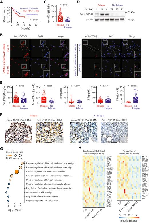Active TGF-β1 levels are upregulated significantly in the bone marrow of AML patients with early relapse after allo-HSCT. (A) Kaplan-Meier analyses of overall survival rates of AML patients from the Gene Expression Profiling Interactive Analysis dataset according to TGF-β1 expression levels. High TGF-β1 expression (n = 87); Low TGF-β1 expression (n = 86). Median value was used as the cutoff. P value was calculated by log-rank test. (B) Representative confocal microscopy images showing the levels of active TGF-β1 in BMMCs isolated from AML patients with early relapse (left) or without relapse (right) after allo-HSCT. Scale bar, 50 μm. (C) Mean fluorescence intensity (MFI) of active TGF-β1 in randomly selected single BMMCs from AML patients with early relapse (red; n = 5 patients) or without relapse (blue; n = 7 patients). Each dot represents MFI of active TGF-β1 in a single cell of the 2 groups; the number of cells were 65 and 31, respectively. (D) Western blotting analysis showing the levels of active TGF-β1 in the BMMCs of AML patients with early relapse (n = 3) or without relapse (n = 3). (E) ELISA or cytometric bead array results showing the levels of total TGF-β1, active TGF-β1, interleukin (IL)-10, IL-4, and IFN-γ in the bone marrow of AML patients with early relapse (n = 16) or without relapse (n = 22). (F) Representative immunohistochemistry images showing the staining intensity for active TGF-β1 in bone marrow biopsy samples from AML patients with early relapse or without relapse. Scale bars, 100 μm. (G) Functional enrichment analyses of differentially expressed genes between control and active TGF-β1-treated NK cells indicating the most enriched biological processes. (H) Heat maps show normalized expression levels of genes regulating NK cell-mediated cytotoxicity (left) and NK cell activation (right) in purified BMNK cells pretreated with dimethyl sulfoxide (solvent control), latent TGF-β1 (10 ng/mL), or active TGF-β1 (10 ng/mL). Each column depicts 1 sample. The data in C and E were analyzed by 2-tailed unpaired t-test; ∗P < .05; ∗∗P < .01; ∗∗∗P < .001; ∗∗∗∗P < .0001. Data are represented as means ± standard deviation.