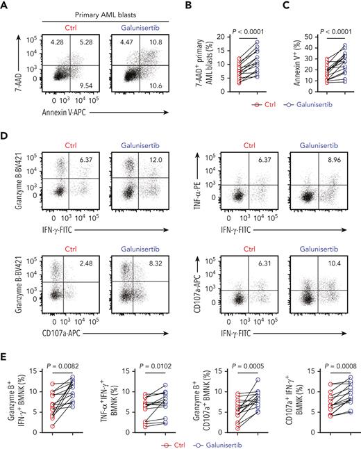 Inhibition of TGF-β1 signaling restores antileukemic activity of NK cells. (A-C) Flow cytometry analysis showing the percentage of 7-AAD+ primary AML blasts and Annexin V + primary AML blasts (target cells) when cocultured for 5 hours with NK cells purified from the bone marrow of AML patients with early relapse. The BMNK cells were pretreated with dimethyl sulfoxide (solvent control) or galunisertib (10 μM) for 24 hours before coculture. NK cell: target cell ratio = 5:1. (D-E) Flow cytometry analysis indicating the proportions of IFN-γ+ granzyme B+ NK cells, IFN-γ+ TNF-α+ NK cells, granzyme B+ CD107a+ NK cells, IFN-γ+ CD107a+ NK cells among control and galunisertib-treated NK cells isolated from the bone marrow of AML patients with early relapse. n = 15. (F-G) Flow cytometry analysis showing the proportion of pSMAD2/3+ NK cells (upper left), pS6+ NK cells (upper right), tetramethylrhodamine methyl ester+ NK cells (lower left), and MitoTracker Green+ NK cells (lower right) among control and galunisertib-treated NK cells isolated from the bone marrow of AML patients with early relapse. n = 15. (H) Experimental scheme: NCG mice were injected with 5 × 105 HL60 cells stably expressing luciferase into the tail vein. After confirmation of engraftment by BLI on day 7, 2.5 × 106 NK cells were transferred to all the mice via tail vein in combination with vehicle control, 5 × 105 GARP+CD4+ T cells, 5 × 105 GARP+CD4+ T cells in the presence of latent TGF-β1 (50 μL, 5 ng/mL; IP; QW), active TGF-β1 (50 μL, 5 ng/mL; IP; QW) in combination with vehicle control, 5 × 105 GARP+CD4+ T cells in the presence of latent TGF-β1 and galunisertib at 75 mg/kg twice daily (BID) by oral gavage for 21 days, or active TGF-β1 in combination with galunisertib (75 mg/kg; twice daily for 21 days) for treatment. AML burden was monitored by BLI at the indicated time points. (I) BLI of AML burden. (J) AML burden was quantified as the average value of the total flux (p/s). n = 6 mice per group. (K) Kaplan-Meier survival curve of mice bearing HL60 cell−derived tumors. Statistical significance was determined by log-rank Mantel-Cox test. n = 6 mice per group. Data in B, C, E, and G were analyzed by 2-tailed paired t-test. Data in J were analyzed by 1-way analysis of variance with Tukey multiple comparisons test. ∗P < .05; ∗∗P < .01; ∗∗∗P < .001; ∗∗∗∗P < .0001. Data are represented as means ± standard deviation.