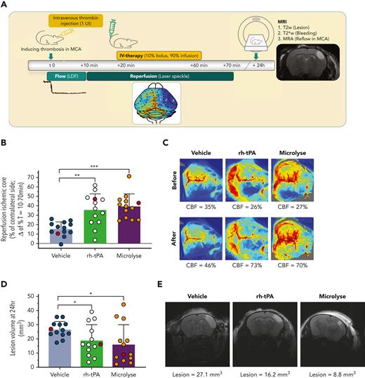 Fibrin-rich thrombosis model (thrombin induced; rh-tPA sensitive). (A) AIS was induced by intravascular injection of thrombin into the MCA. Clot formation was considered to be stable when blood flow in the MCA was zero for 10 minutes. Cortical perfusion over the entire dorsal brain area was measured via speckle imaging between T = 10 minutes and T = 70 minutes. Treatment was given at T = 20 minutes as a 10% bolus and 90% infusion over 40 minutes. MRI was performed after 24 hours to assess lesion volumes (T2 weighted), possible hemorrhage (T2∗-weighted), and MCA recanalization (MR angiography). (B) Bar graph (mean ± standard deviation) displaying the percentage of reperfusion of the ischemic core, calculated as difference between levels of perfusion 10 minutes after treatment (T = 70 minutes) and 10 minutes before treatment (T = 10 minutes). From individual mice indicated as red circles (reflecting median values), images are presented hereafter. (C) Representative laser speckle flow images (from subjects indicated at red circles in panel B) before and after treatment from a single mouse per group. Reperfusion is visible when the blue hemisphere (bottom half of each image) before treatment is turning green, yellow, or red after treatment. The mean CBF levels in the ischemic core (expressed as percent of the unaffected hemisphere) are shown below the images. (D) Bar graph (mean ± standard deviation) displaying lesion volumes, calculated from a T2-weighted MRI. From individual mice indicated as red circles (reflecting median values), images are presented hereafter. (E) Representative T2-weighted images of coronal mouse brain slices displaying the hyperintense lesion area in a single mouse per group (indicated as red circles in D). Lesion volume values are shown below the images. Asterisks indicate significance levels as measured by Mann-Whitney U tests: ∗P < .05; ∗∗P < .01; ∗∗∗P < .001. CBF, cerebral blood flow.