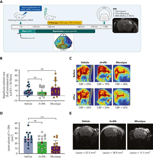 Platelet-rich thrombosis model (FeCl3 induced; rh-tPA resistant). (A) AIS was induced by topical application of FeCl3 on the MCA. (B) Bar graph (mean ± standard deviation) displaying the percentage of reperfusion of the ischemic core, calculated as difference between levels of perfusion 10 minutes after treatment (T = 70 minutes) and 10 minutes before treatment (T = 10 minutes). From individual mice indicated as red circles, images are presented hereafter. (C) Representative laser speckle flow images (from subjects indicated at red circles in panel B) before and after treatment from a single mouse per group. Reperfusion seems to be absent as the blue and green hemisphere (bottom half of each image) before treatment remains blue and green after treatment. The mean CBF levels in the ischemic core (expressed as percent of the unaffected hemisphere) are shown below the images. (D) Bar graph (mean ± standard deviation) displaying lesion volumes, calculated from a T2-weighted MRI. From individual mice indicated as red circles (reflecting median values), images are presented hereafter. (E) Representative T2-weighted images of coronal mouse brain slices displaying the hyperintense lesion area in a single mouse with median lesion volume per group (indicated as red circles in panel D). Lesion volume values are shown below the images. Asterisks indicate significance levels as measured by Mann-Whitney U tests: ∗P < .05; ∗∗P < .01; ∗∗∗P < .001. CBF, cerebral blood flow.