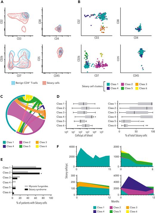 Immunophenotypic features of constant beta chain–restricted Sézary cells showing complex multicluster composition and overlap with benign T-cell subsets. (A) Density plots showing extensive immunophenotypic overlap between constant beta chain–restricted Sézary cells from patients with CTCL (red lines), and benign CD4+ T cells from patients with inflammatory dermatoses (blue lines). Double lines depict 2 standard deviations. (B) Metaclustering (K-means) of constant beta chain–restricted Sézary cell clusters showing distinct immunophenotypic subtypes on 2-dimensional projections (described as class 1-6). (C) Circos plot depicting the incidence (segments) and observed combinations (ribbons) of Sézary cell metaclusters. (D) Contribution of each immunophenotypic class of Sézary cell to the total Sézary cell count based on absolute numbers of cells per microliter (left) and percentage of total Sézary cells (right). Box and whiskers: median, interquartile range and total range. Asterisks (∗), (∗∗), and (∗∗∗) indicate P < .05, P < .01, and P < .0001, respectively, compared to class 1. (E) Incidence of each immunophenotypic class of Sézary cell (first positive sample only) in patients with mycosis fungoides (grey bars) and Sézary syndrome (black bars). Asterisk (∗) indicates P < .05. (F) Examples of patients with Sézary syndrome (top) and mycosis fungoides (bottom), showing variability of Sézary cell metacluster composition and abundance on serial samples.