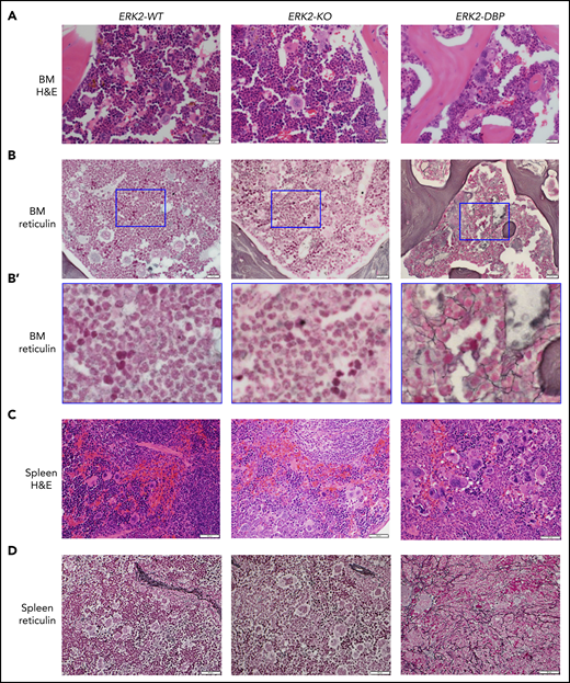 Morphologic evidence of MF in the BM and spleen of mice receiving ERK2-DBP–mutant HSPCs. (A-B) Hematoxylin and eosin and reticulin staining of representative BM sections from mice that received ERK2-WT–, -KO– and -DBP–mutant HSPCs, at 12 weeks after BM transplant. (B′) Enlarged images delimited by the blue inset in panel B. Scale bars, 20 µm. (C-D) Representative images of sections of spleen from the mice above, stained with hematoxylin and eosin (C) or reticulin (D) 12 weeks after BMT. Scale bars, 50 µm.