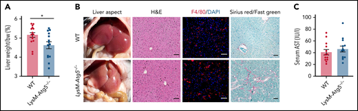 LysM-Atg5−/− mice had normal hepatic histology but mild fibrosis. (A) Histogram of the mean and standard error values with dot plots of liver weight normalized to body weight (bw; n = 14-15 in each group). (B) Representative liver anatomy of LysM-Atg5−/− and WT mice. Immunofluorescence of liver sections stained with a phycoerythrin-conjugated anti-F4/80 antibody (red) and 4′,6-diamidino-2-phenylindole (DAPI; blue) for nuclear staining showing similar Kupffer cell distribution (Leica fluorescence microcopy imaging; original magnification, 20×; scale bars, 20 μm). Liver sections stained with hematoxylin and eosin (H&E) and Sirius red with Fast green counterstaining (NanoZoomer scan imaging; original magnification, 20×; scale bars, 50 μm); Sirius red+ areas of collagen (red) are indicative of mild liver fibrosis in LysM-Atg5−/− mouse livers. Histologic staining panels are representative of LysM-Atg5−/− and WT mice (n = 8 per group). (C) Histogram of the mean and standard error values with dot plots of serum AST levels (n = 12-15 in each group). *P < .05.