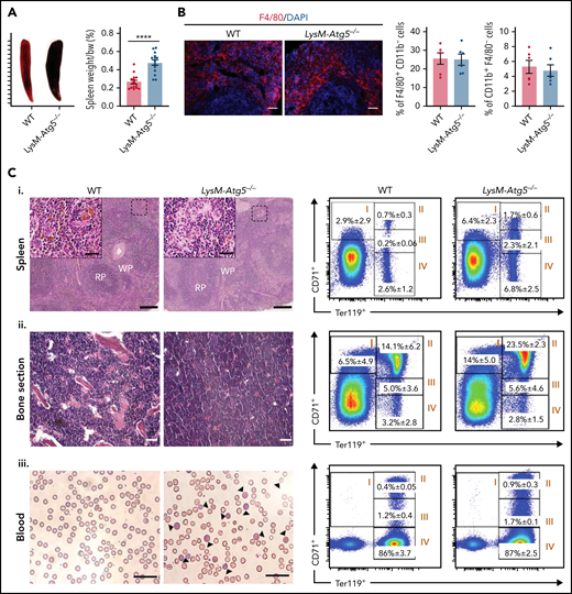 Increased erythropoiesis in LysM-Atg5−/− mice. (A) Representative example of LysM-Atg5−/− and WT mouse spleens and ratios (%) of spleen weight to body weight (bw). Data are presented as histograms of the mean and standard error values, with individual measurements (n = 14-15 in each group). (B) Macrophage localization and cell count. Immunofluorescence with a phycoerythrin-conjugated anti-F4/80 antibody for macrophage staining (red) and 4′,6-diamidino-2-phenylindole (DAPI; blue) for nuclear staining; flow cytometric analysis results depicted as dot plot–type histograms (mean values and standard errors; n = 6) showing the F4/80+/CD11b− macrophage and CD11b+/F4/80− monocyte populations in the spleens of LysM-Atg5−/− and WT mice (Leica fluorescence microcopy imaging; original magnification, 20×; scale bars, 20 μm; gating strategy shown in supplemental Figure 3A). (C) Spleen (i) and BM (ii) histology and blood cell analysis (iii) with flow cytometric plots showing erythroid lineage cells from LysM-Atg5−/− and WT mice. (Ci) Hematoxylin and eosin (H&E)–stained sections of spleen tissue (NanoZoomer scan imaging; original magnification, 5×; scale bars, 200 μm; representative from n = 10 per group). The insets in the spleen panels show enlarged images of the boxed regions (original images, 40×; scale bars, 20 μm) showing brown hemosiderin deposits in WT mice and erythroblastic islands consisting of a central nurse macrophage surrounded by a ring of developing RBC precursors in LysM-Atg5−/− mice. (Cii) H&E-stained bone sections (Leica microcopy imaging; original magnification, 20×; scale bars, 20 μm; representative from n = 3 per group). (Ciii) Peripheral blood smears stained with May-Grunwald-Giemsa stain; arrows indicate hematoxylin blue–stained reticulocytes (NanoZoomer scan imaging; original magnification, 20×; scale bars, 20 μm). Representative flow cytometric plots for spleen, BM, and blood showing erythroid precursors based on CD71 and Ter119 markers used to separate the erythroid progenitors (gating strategy is shown in supplemental Figure 3A). The relative percentages of cells in stages I to IV of erythropoiesis with stage I single-positive CD71+ Ter119− early-stage proerythroblasts (region I), stage II double-positive CD71+ Ter119+ late-stage basophilic erythroblasts (region II), CD71low Ter119+ polychromatic and orthochromatic erythroblasts (regions III and IV), and single-positive CD71− Ter119+ CD11b+ (region IV) in LysM-Atg5−/− and WT mice are indicated (representative histograms of flow cytometry from n = 8-10 per group are shown in supplemental Figure 3B). ****P < 10−4. RP, red pulp; WP, white pulp.