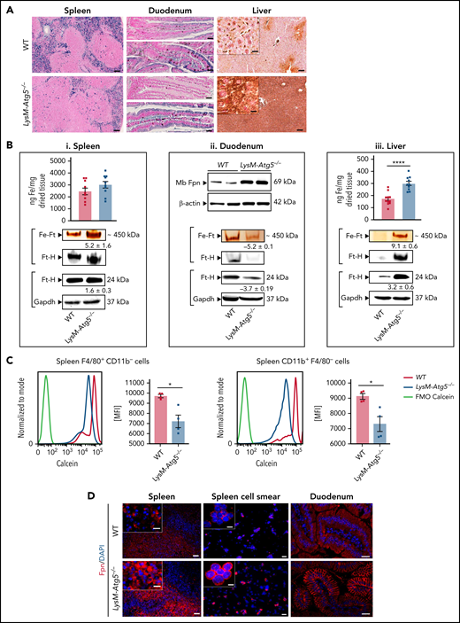 LysM-Atg5−/− mice have splenic and enterocytic iron depletion, ferroportin membrane localization, and body iron overload. (A) Histologic examination of nonheme iron deposits in the spleen, duodenum, and liver in LysM-Atg5−/− and WT mice. Nonheme iron deposition was visualized by Perl’s staining (blue) of spleen and duodenum sections and after DAB enhancement (brown) for liver sections (representative images are shown from n = 12 per group; NanoZoomer scan imaging; original magnification, 10× for spleen and liver and 20× for duodenum; scale bars, 100 μm for spleen and liver and 40 μm for duodenum; enlarged inset images, 40×; scale bars, 20 μm). The duodenum images show the proximal (top) part where food was no longer in transit and the more distal (down) part where food was in transit. Iron was localized in the apical compartment of WT enterocytes in both parts of the duodenum, whereas in LysM-Atg5−/− enterocytes, no iron was seen in the proximal duodenum, but iron was localized in both the apical and basal compartments of the distal duodenum. Enlarged liver images show Kupffer cells stained for iron in WT mice and hepatocyte staining in LysM-Atg5−/− mice. (B) Tissue iron content in the spleen (i top) and liver (iii top) in LysM-Atg5−/− and WT mice, as determined by a ferrozine assay and reported as ng of iron per mg of dried tissue. Data are presented as histograms of the mean and standard error values with dot plots (n = 10 in each group). Representative Fpn immunoblotting from duodenal membrane protein extracts (ii top) from LysM-Atg5−/− and WT mice (n = 2 samples per genotype are shown from 6 mice). Representative staining of ferric iron loaded in ferritin (Fe-Ft) and immunoblotting of ferritin H (Ft-H) in the spleen (i bottom), duodenal (ii bottom), and liver (iii bottom) extracts. For ferric iron–loaded ferritin, 25 ng of native proteins from cytosolic lysates was loaded in each lane of a nondenaturing polyacrylamide gel electrophoresis (PAGE) gel, and after electrophoresis, the gel was directly stained with Perl’s staining solution and enhanced with DAB. The gel was then immunoblotted for Ft-H as a control for the band specificity (representative images from n = 4 experiments are shown). For Ft-H western blot, 25 ng of cytoplasmic extracts was loaded on a denaturing PAGE gel, and glyceraldehyde-3-phosphate dehydrogenase (Gapdh) is shown as the loading control. Densitometric analysis was performed on the immunoblot shown as well as on immunoblots with lysates from 3 additional LysM-Atg5−/− and WT mice; after normalization to Gapdh in each lane, LysM-Atg5−/− results were normalized to the WT control group average. Data are presented as means ± standard errors. (C) Calcein fluorescence quenching assay in spleen cells from LysM-Atg5−/− and WT mice for measurement of the labile iron pool. Immediately after recovery, cells dissociated from the spleen were stained simultaneously with calcein (CA-AM) and anti-mouse PerCP-conjugated CD11b and phycoerythrin-Cy7–conjugated F4/80 antibodies and were then analyzed by flow cytometry. Gates were set on FSC, CD45, and TCRβ. Representative calcein fluorescence profiles of unstained cells (FMO-calcein) and Calcein-AM–stained cells (WT and LysM-Atg5−/−) with respect to cell markers are shown, and histograms with the mean and standard error values from 3 independent experiments are shown as dot plots (from n = 3 independent experiments). (D) Detection of ferroportin by immunofluorescence in spleen tissues, isolated cells from the spleen, and proximal duodenal villi from LysM-Atg5−/− and WT mice. Representative images are composites from ferroportin (red) and 4′,6-diamidino-2-phenylindole (DAPI)-stained nuclei (blue) (n = 4 animals per group; for spleen and spleen cell smear: Leica fluorescence microcopy imaging; original magnification, 20×; scale bars, 20 μm; enlarged inset images, magnification 100×; scale bars, 5 μm; for liver: Zeiss inverted microscopy imaging; original magnification, 20×; scale bars, 20 μm). *P < .05, ****P < 10−4. MFI, mean fluorescence intensity.