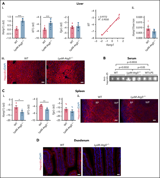 Hamp1 expression in LysM-Atg5−/− mice. (Ai) Liver Hamp1, Id1, and Fga mRNA levels (relative to Gapdh) expressed as −ΔCt values and correlation of Hamp1 and Id1 mRNA levels (n = 8 per group). (Aii) Ratio of liver Hamp1 mRNA levels to hepatic iron content. (Aiii) Detection of hepcidin by immunofluorescence in liver tissue from LysM-Atg5−/− and WT mice. Representative images are composites from hepcidin (red) and 4′,6-diamidino-2-phenylindole (DAPI)–stained nuclei (blue) (n = 4 animals per group; Leica fluorescence microcopy imaging; acquisition time, 3.000 ms; original magnification, 10×; scale bars, 50 μm). (B) Dot blotting of serum hepcidin from LysM-Atg5−/− and WT mice; 5 μL of serum samples were spotted. Three samples per genotype and controls of WT mice stimulated with lipopolysaccharide (LPS; 5 μg/25 g) 24 hours before necropsy are shown (control dot blots of 10% milk and serum from WT mice fed iron-replete, iron-deficient, and iron-rich diets are shown in supplemental Figure 4D; densitometric analysis was performed on n = 6 samples per group, and P values are given). (Ci) Spleen Hamp1, Id1, and Fga mRNA levels (relative to Gapdh) expressed as −ΔCt values (values are the mean of n = 6 experiments). Data are presented as means and standard errors (n = 6 per group). (Cii) Detection of hepcidin by immunofluorescence in spleen from LysM-Atg5−/− and WT mice. Representative images are composites from hepcidin (red) and DAPI-stained nuclei (blue) (n = 4 animals per group; Leica fluorescence microcopy imaging; acquisition time, 100 ms; original magnification, 10×; scale bars, 50 μm). (D) Detection of hepcidin by immunofluorescence in duodenum from LysM-Atg5−/− and WT mice. Representative images are composites from hepcidin (red) and DAPI-stained nuclei (blue) (n = 3 animals per group; Zeiss inverted microscopy imaging; original magnification, 10×; scale bars, 20 μm). Hepcidin protein was detected using a specific rabbit anti–hepcicin-25 antibody.58 *P < .05, **P < .01, ***P < .001. RP, red pulp; WP, white pulp.